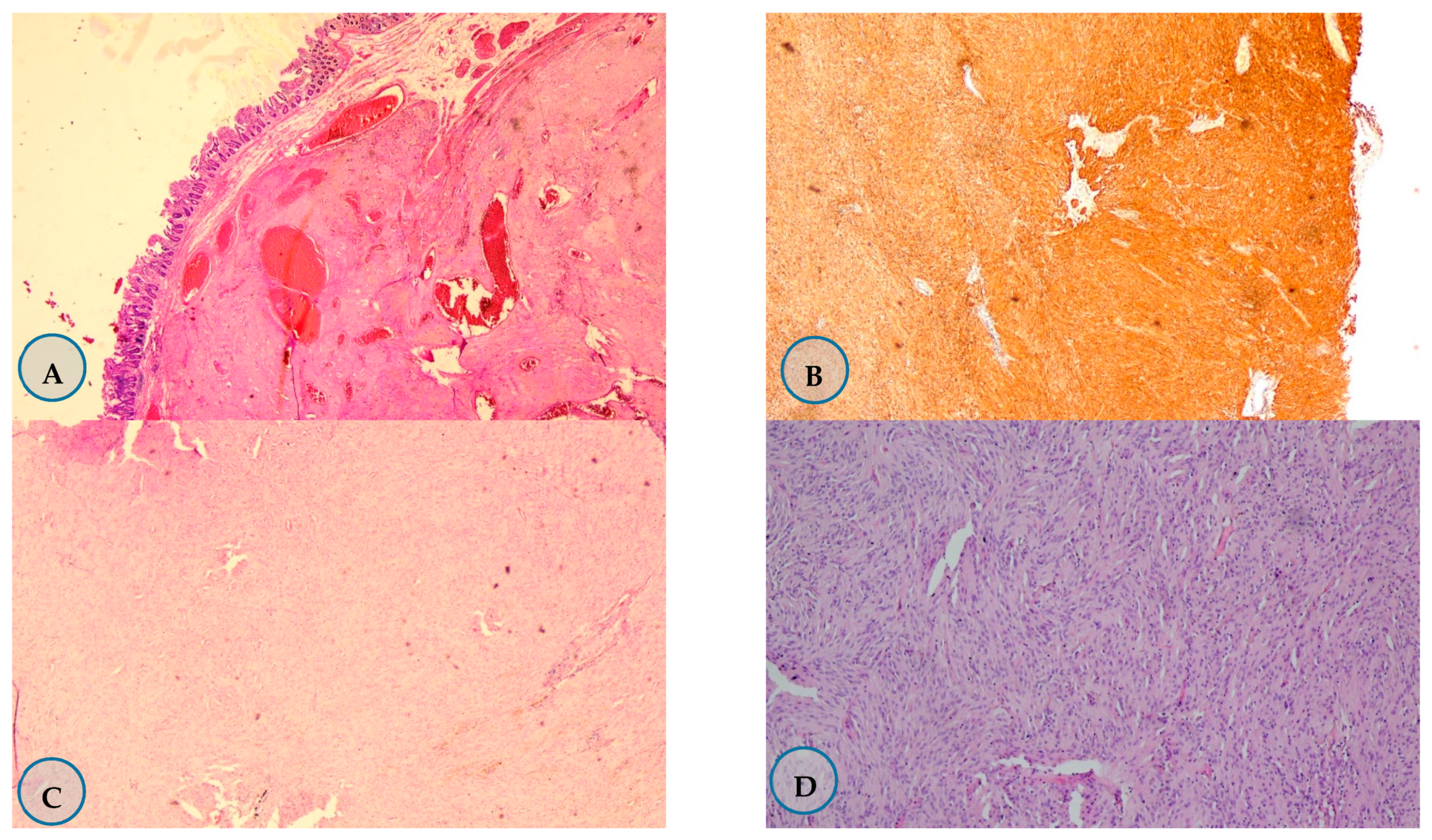 Medicina 57 00494 g002 Medicina 57 00494 g002