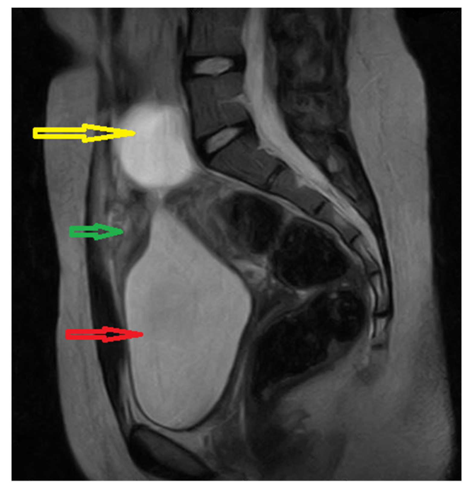 Medicina 57 00495 g001
