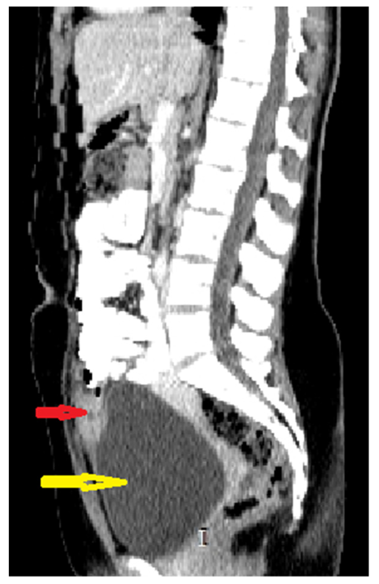 Medicina 57 00495 g002
