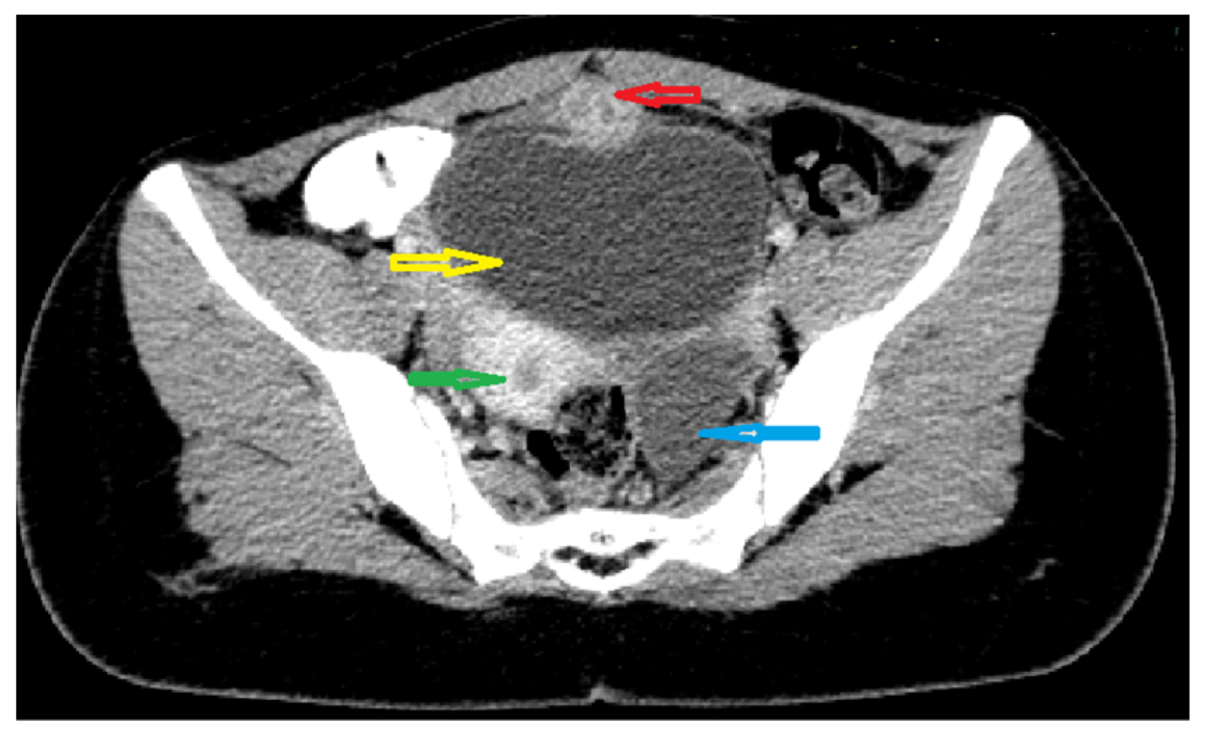 Medicina 57 00495 g003