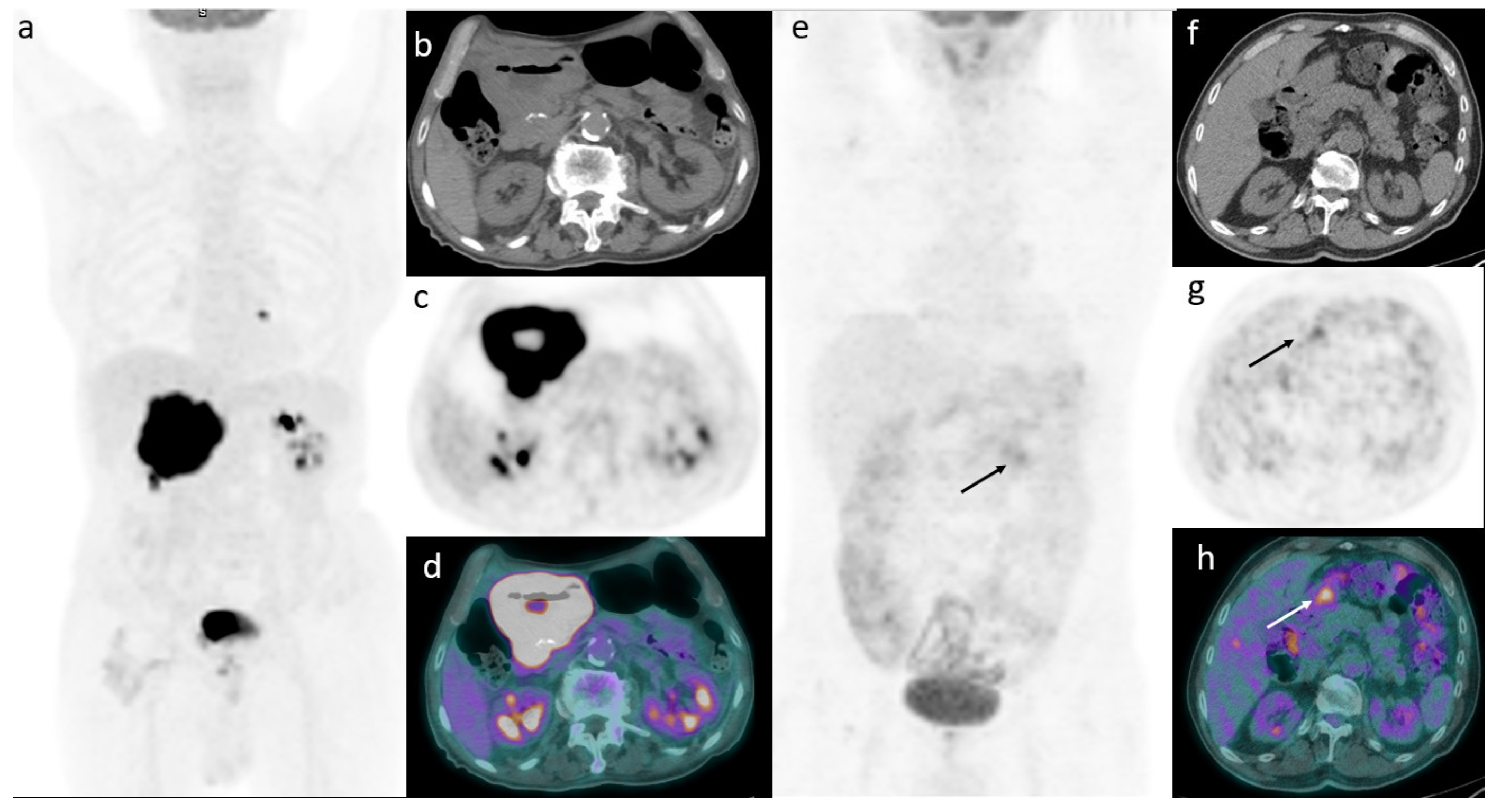 Medicina 57 00498 g001 Medicina 57 00498 g001
