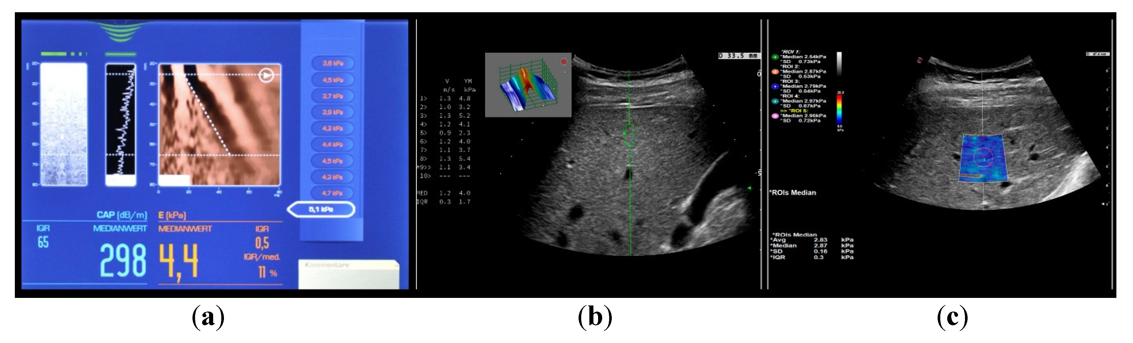 Medicina 57 00516 g002