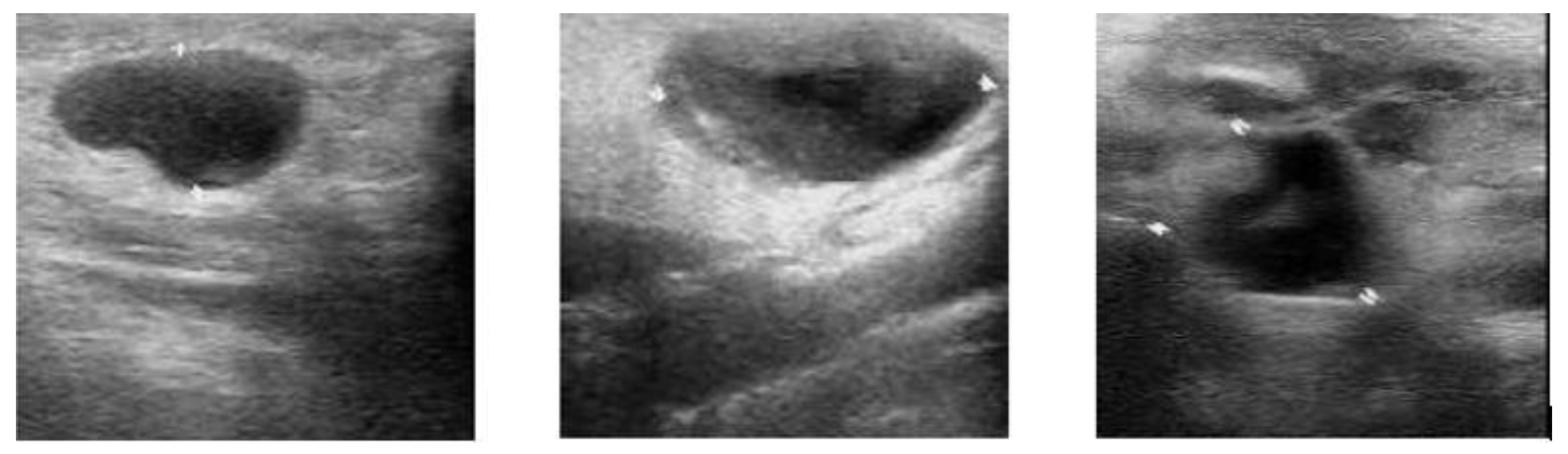 Medicina 57 00527 g004 Medicina 57 00527 g004