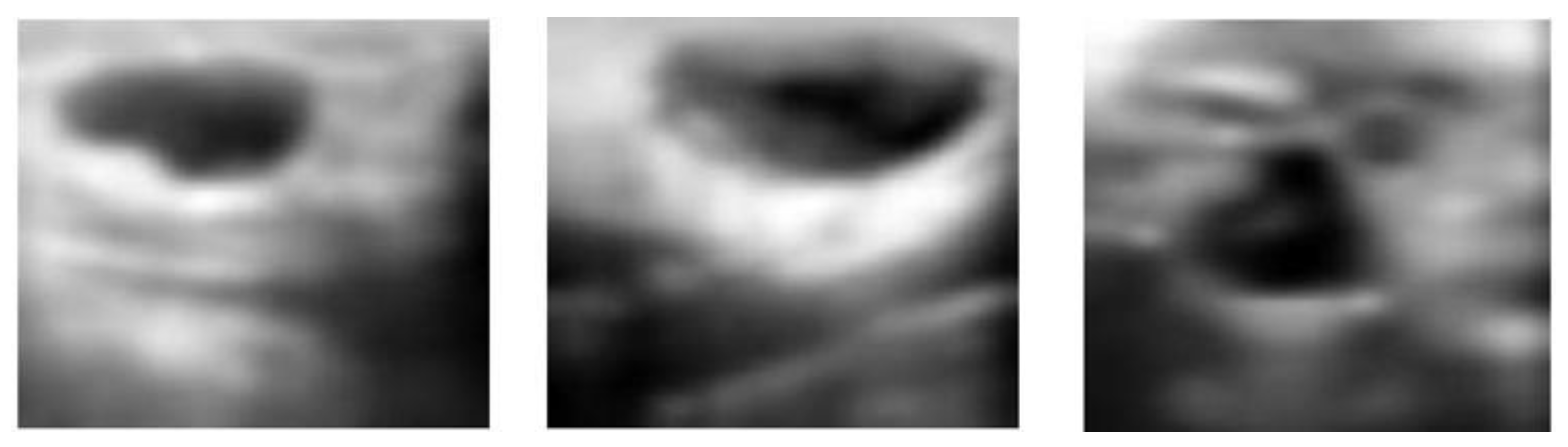 Medicina 57 00527 g005 Medicina 57 00527 g005