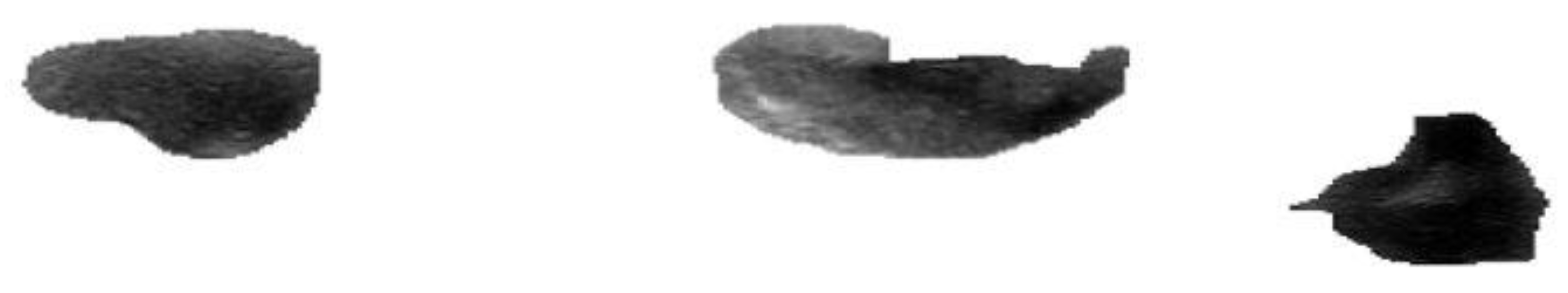 Medicina 57 00527 g007 Medicina 57 00527 g007