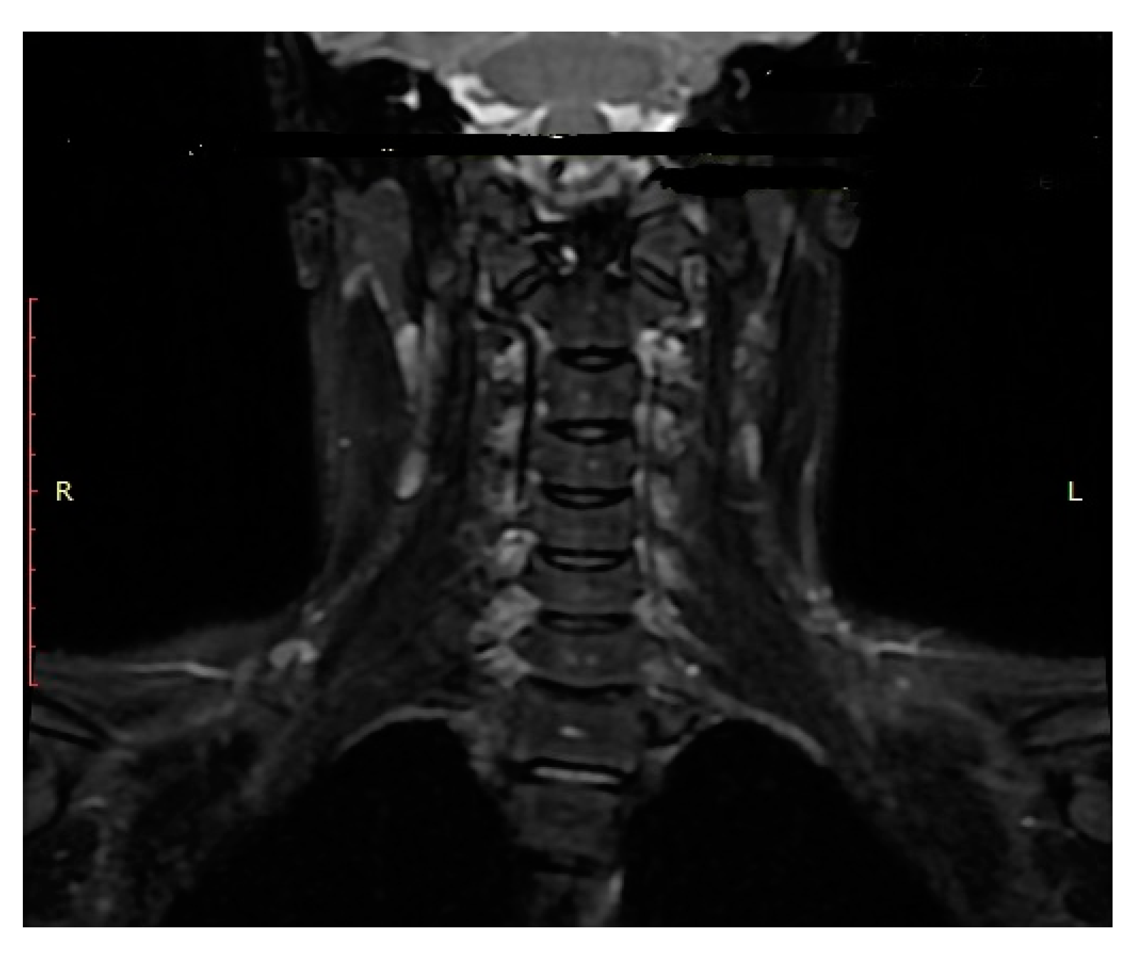 Medicina 57 00530 g005