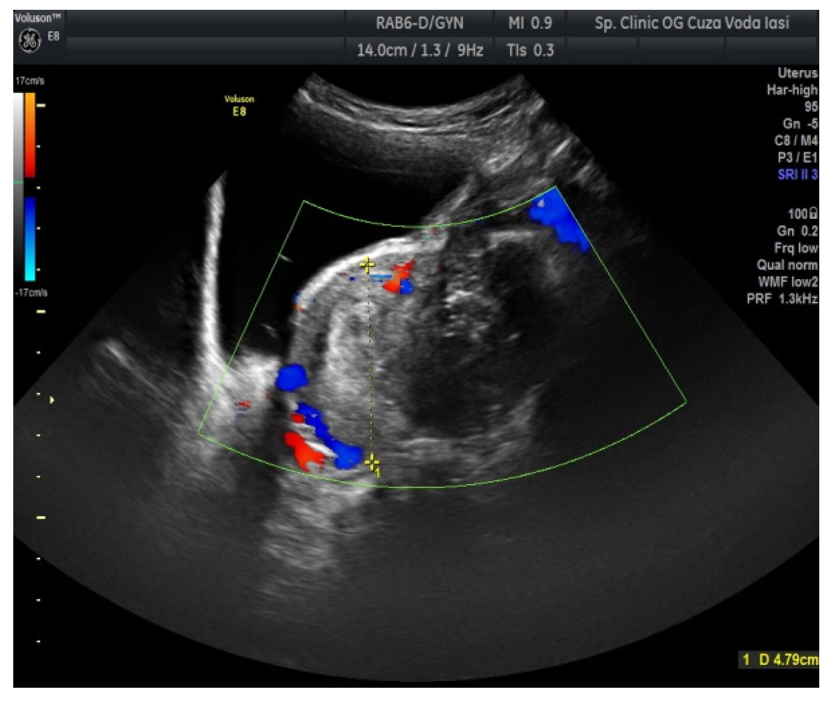 Medicina 57 00534 g002 Medicina 57 00534 g002