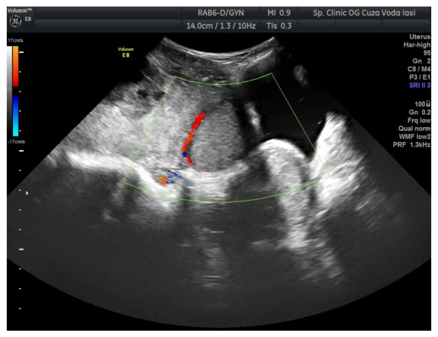 Medicina 57 00534 g003 Medicina 57 00534 g003