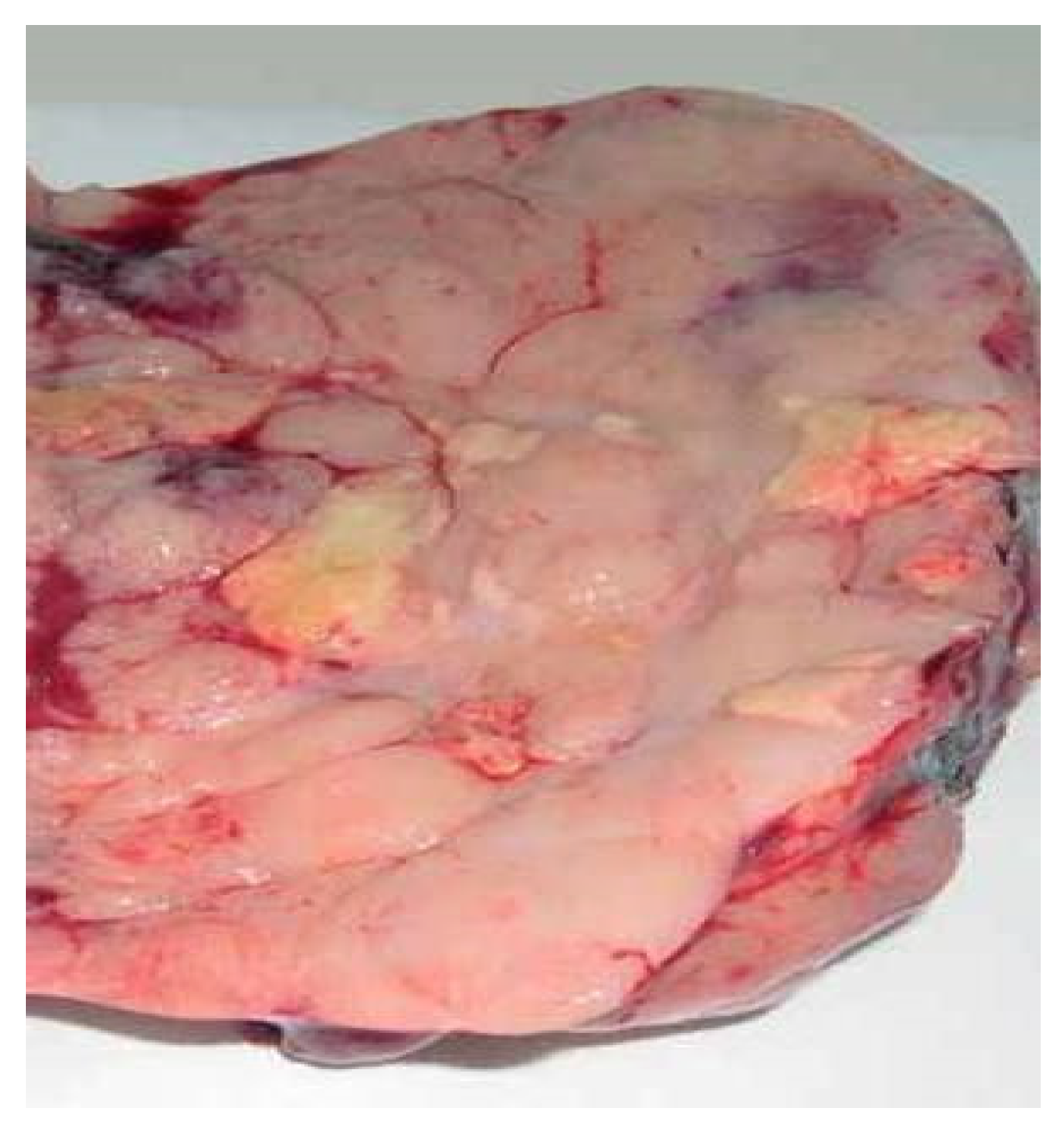 Medicina 57 00534 g005 Medicina 57 00534 g005