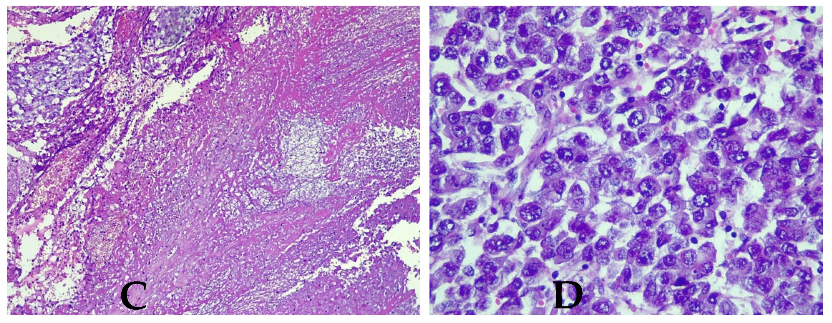 Medicina 57 00534 g006b Medicina 57 00534 g006b