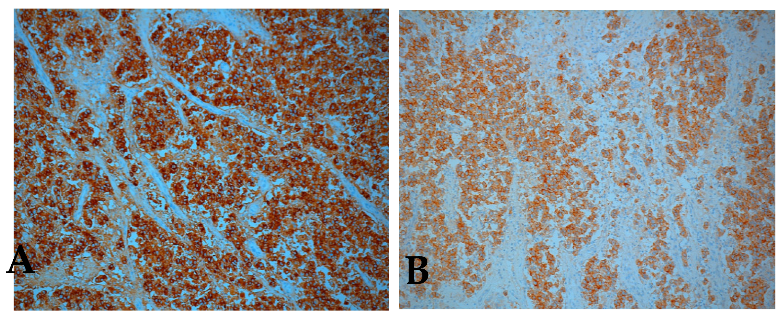 Medicina 57 00534 g007 Medicina 57 00534 g007
