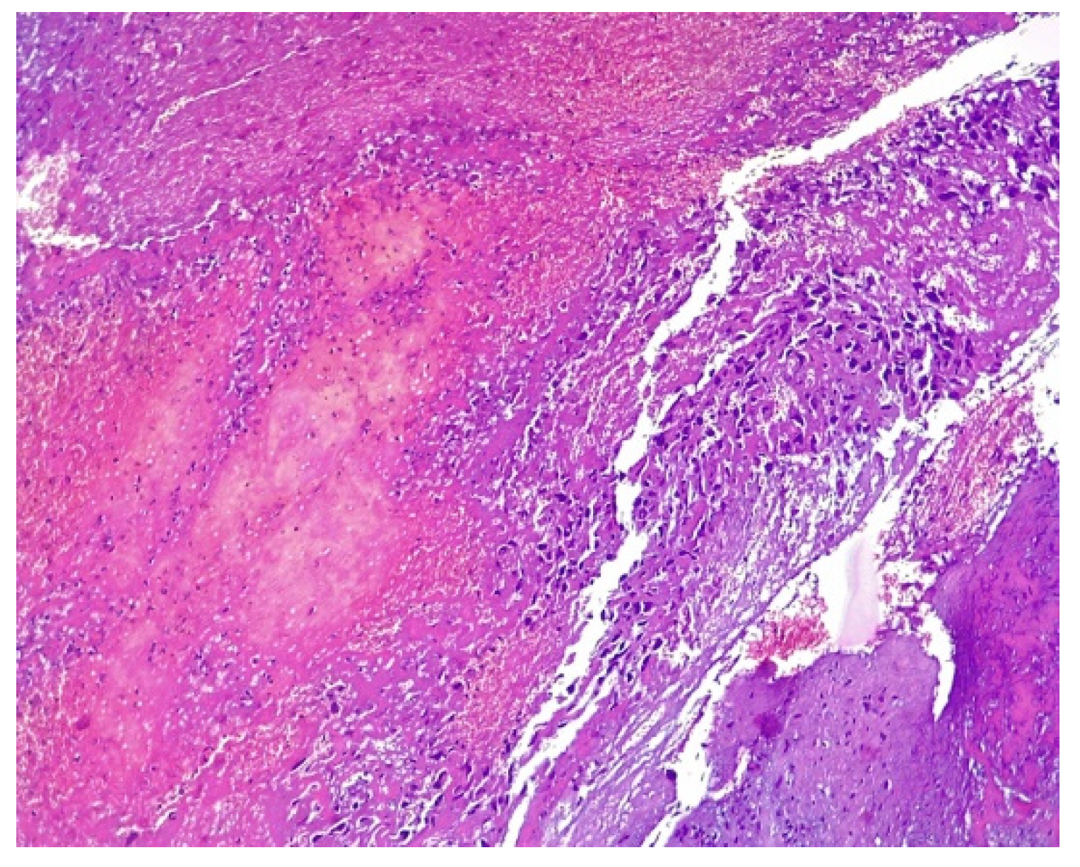 Medicina 57 00534 g010 Medicina 57 00534 g010