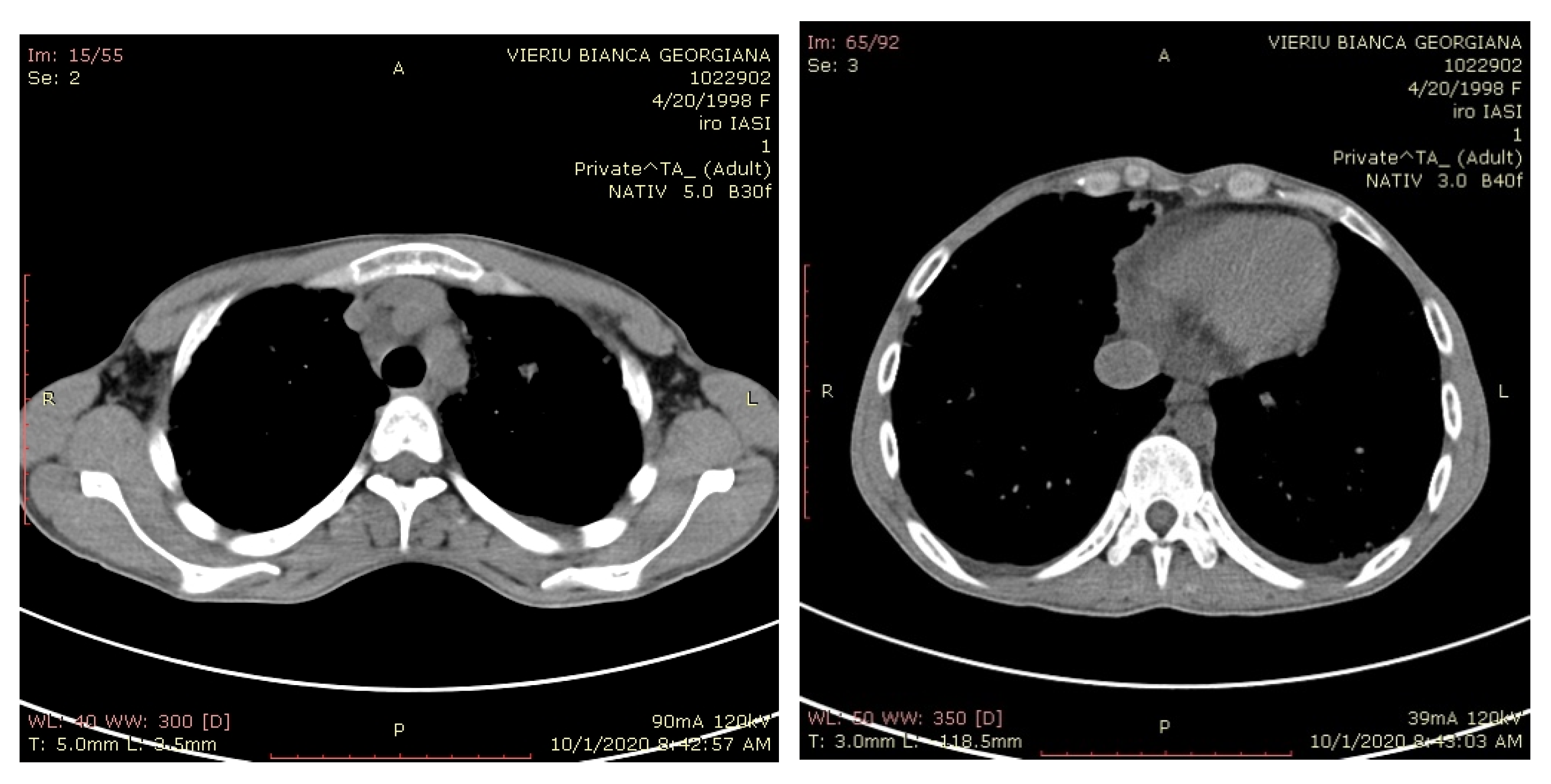 Medicina 57 00534 g011 Medicina 57 00534 g011