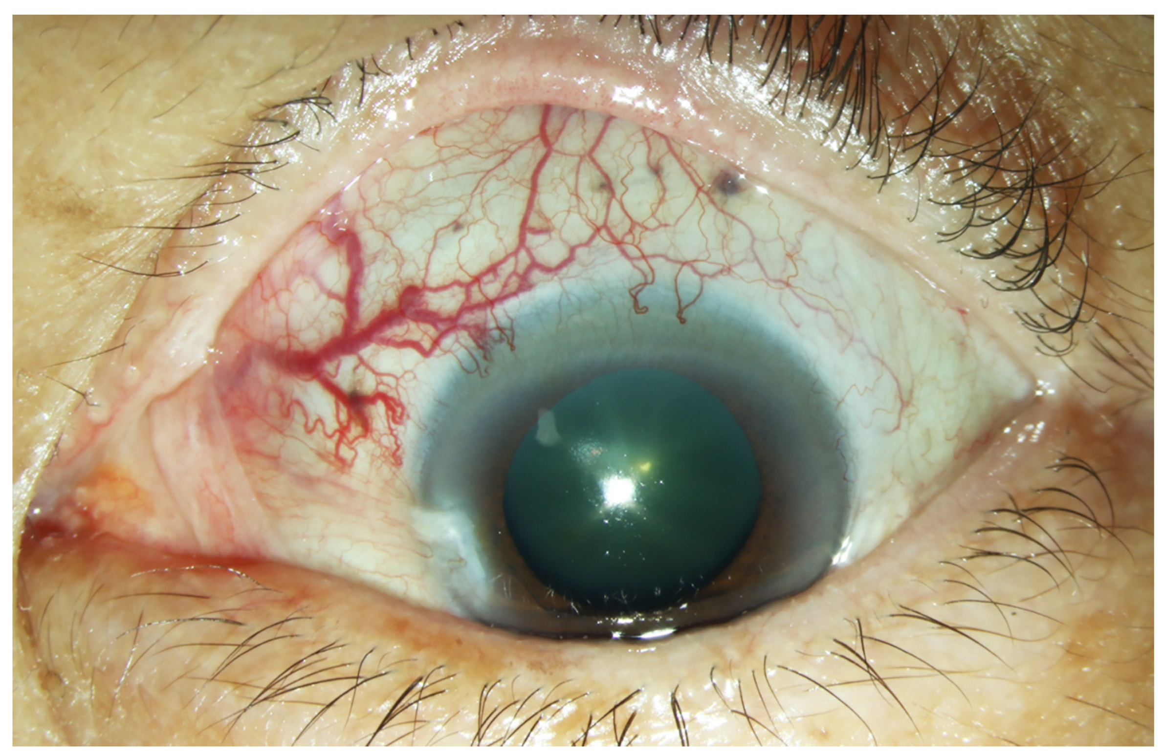 Medicina 57 00539 g001