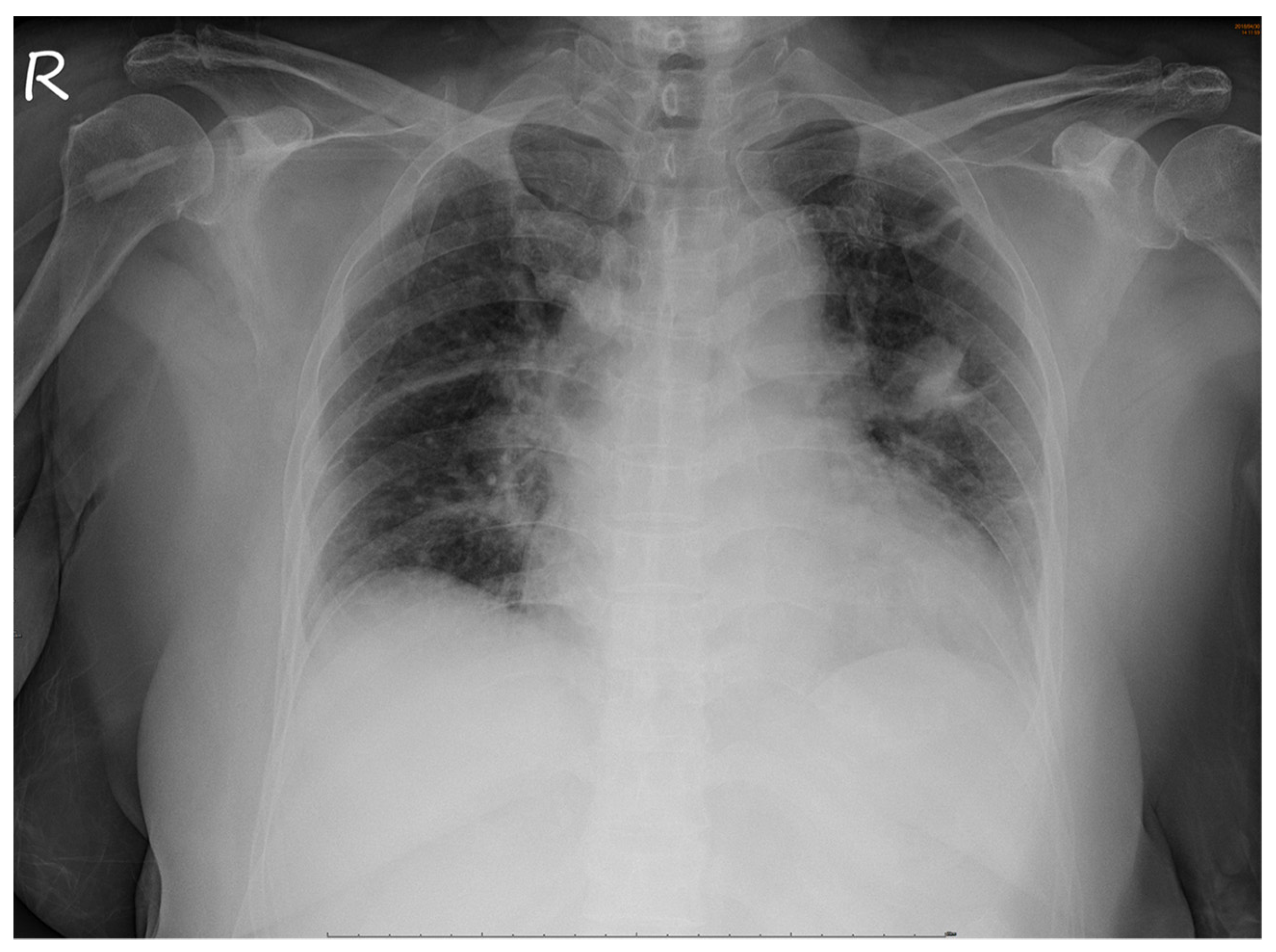 Medicina 57 00539 g004