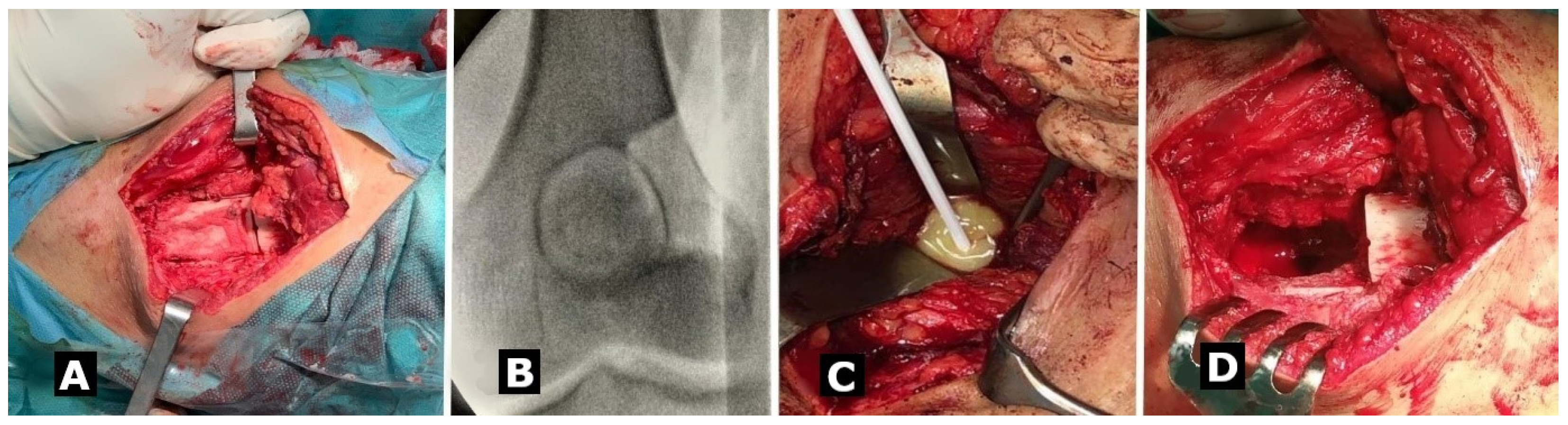 Medicina 57 00544 g002