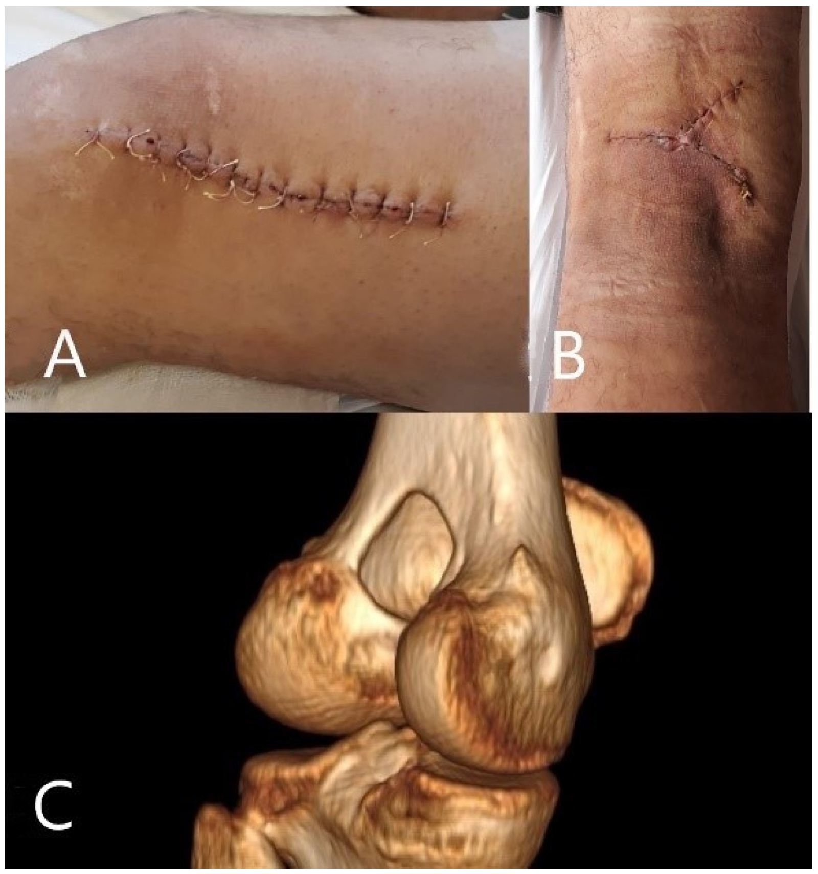 Medicina 57 00544 g003