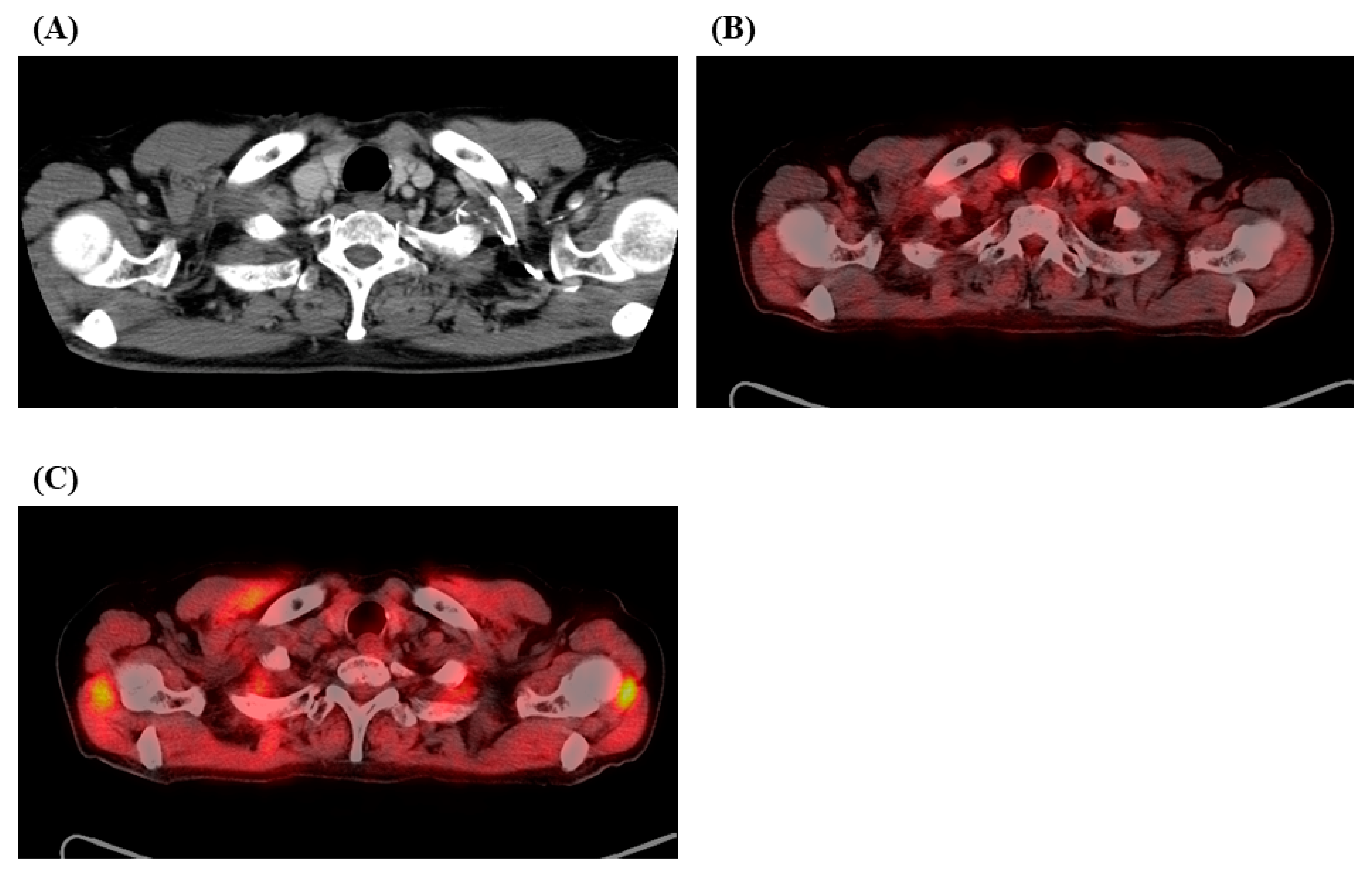 Medicina 57 00547 g002