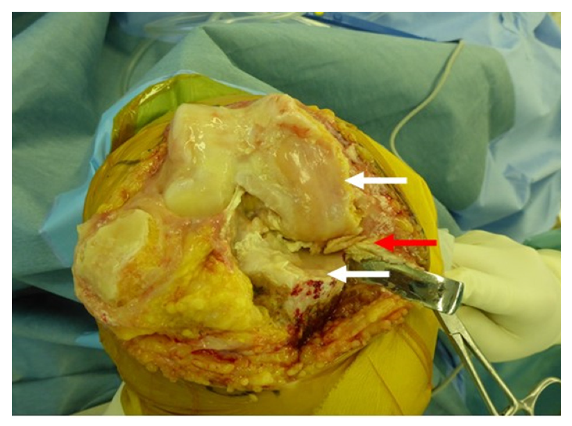 Medicina 57 00550 g002 Medicina 57 00550 g002