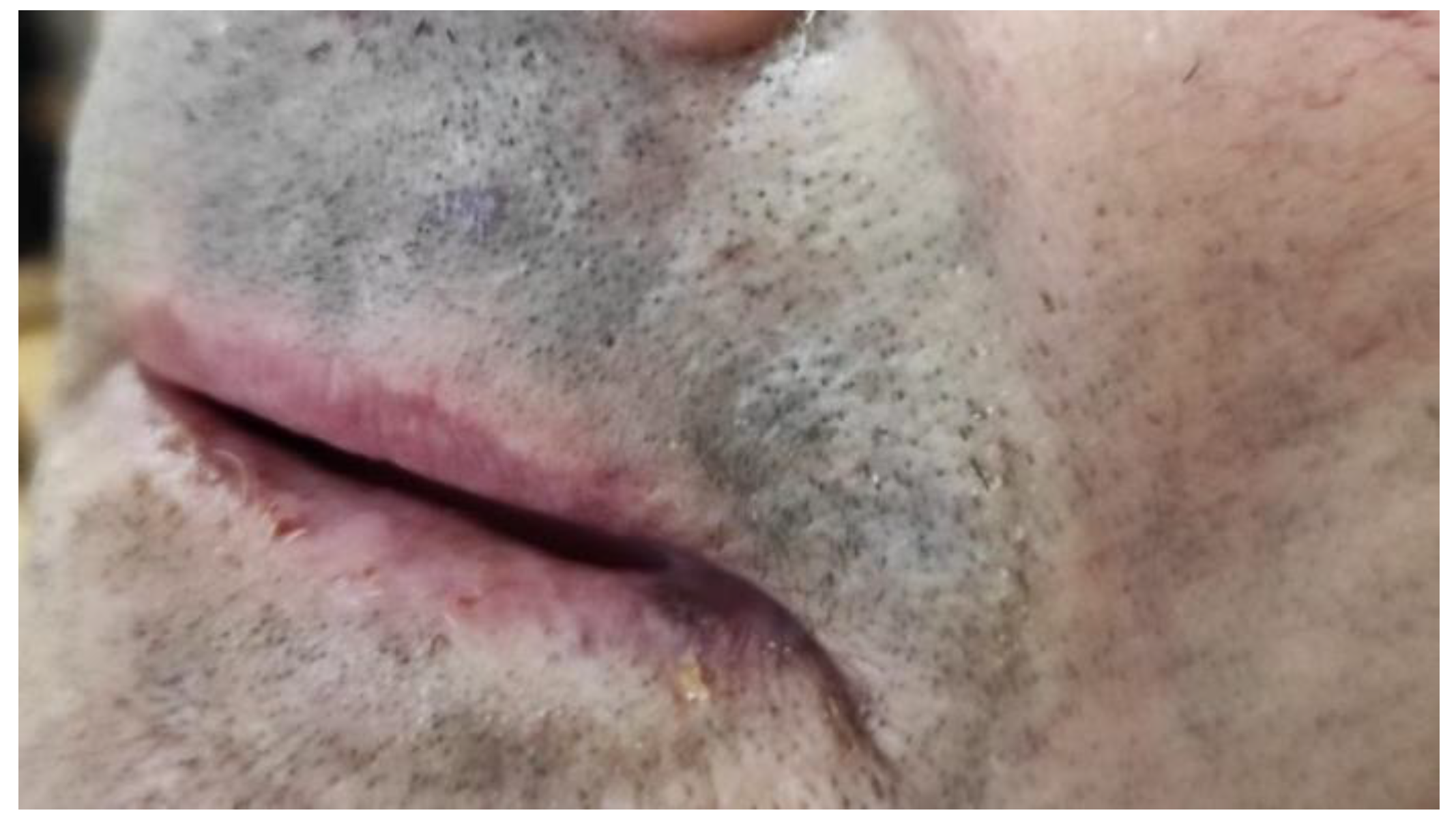 Medicina 57 00563 g003