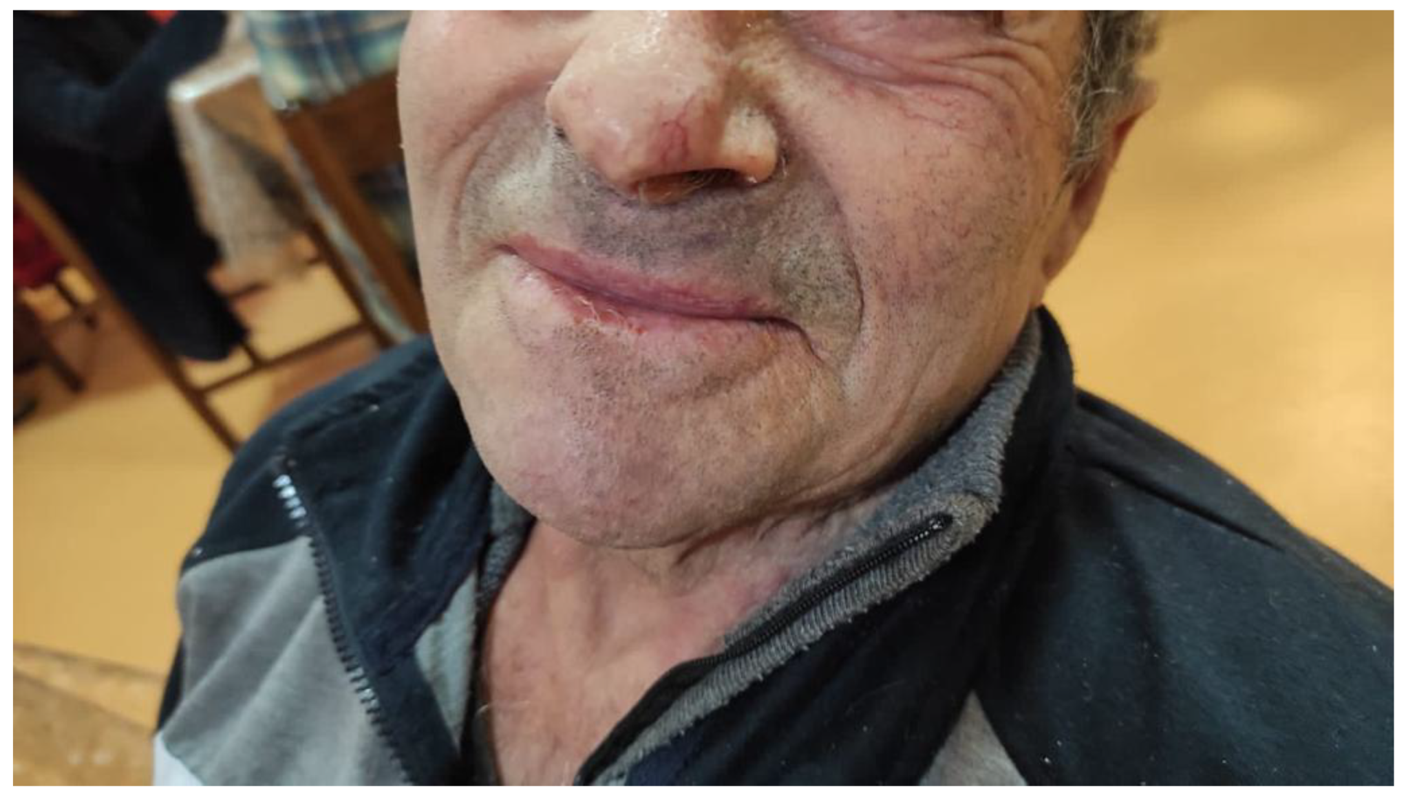 Medicina 57 00563 g004