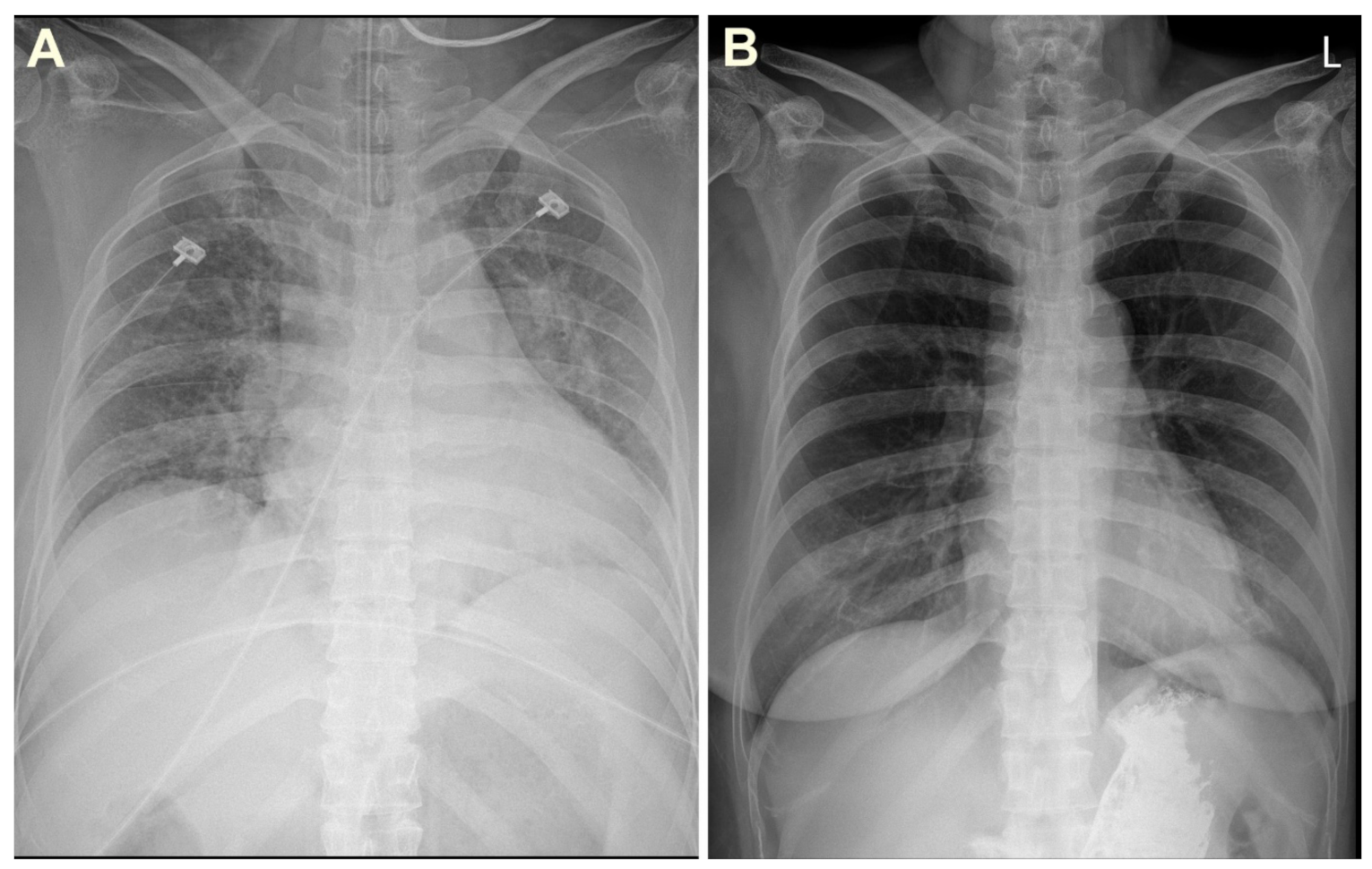 Medicina 57 00564 g002