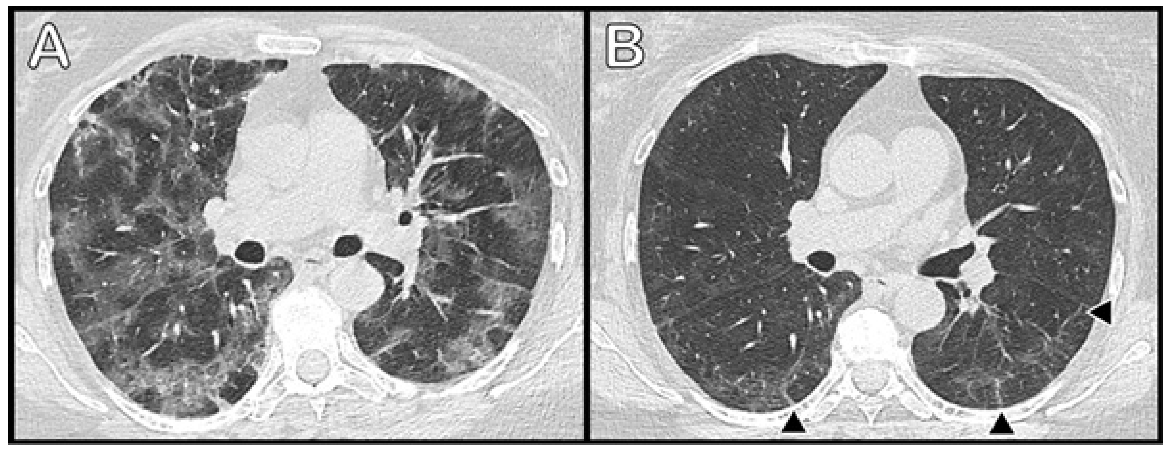 Medicina 57 00568 g002