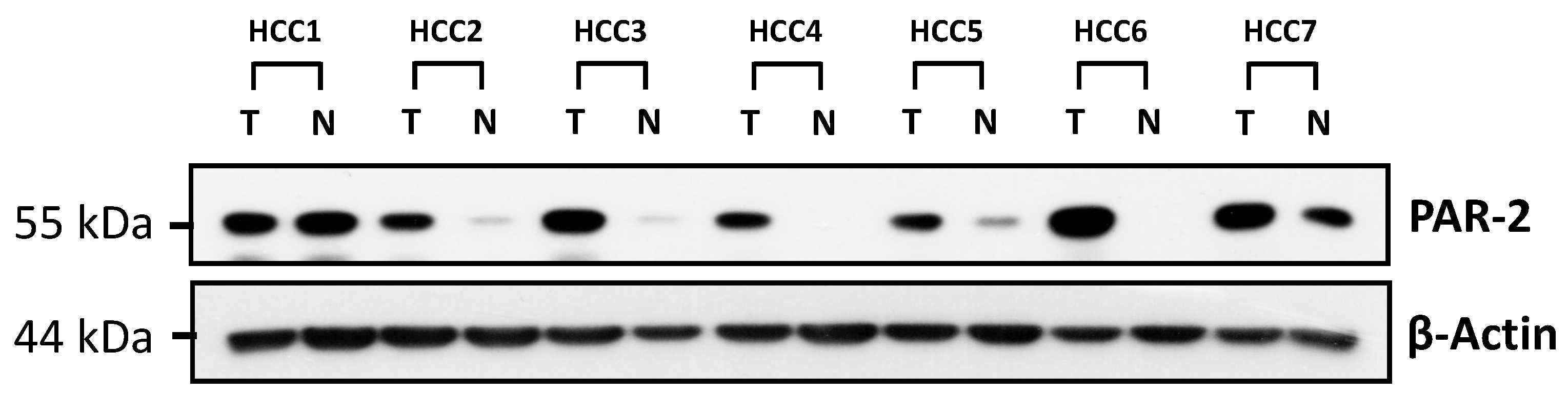 Medicina 57 00574 g001 Medicina 57 00574 g001