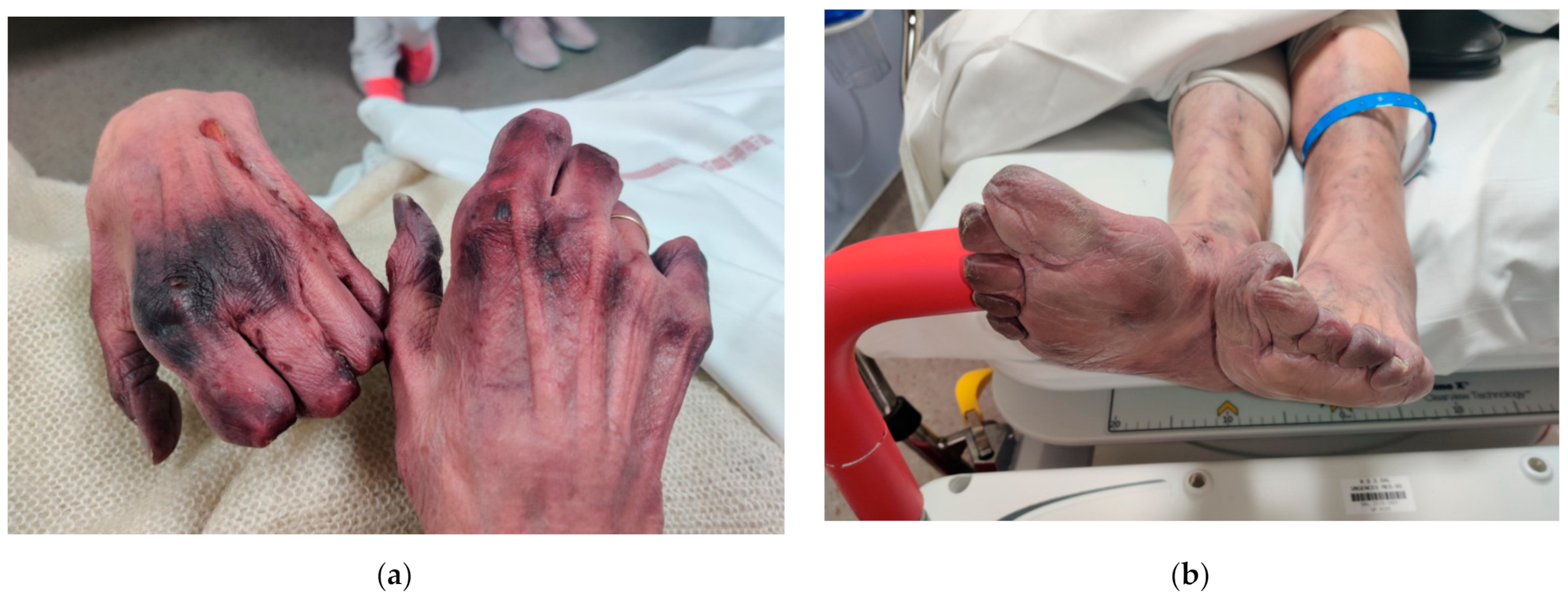 Medicina 57 00592 g001