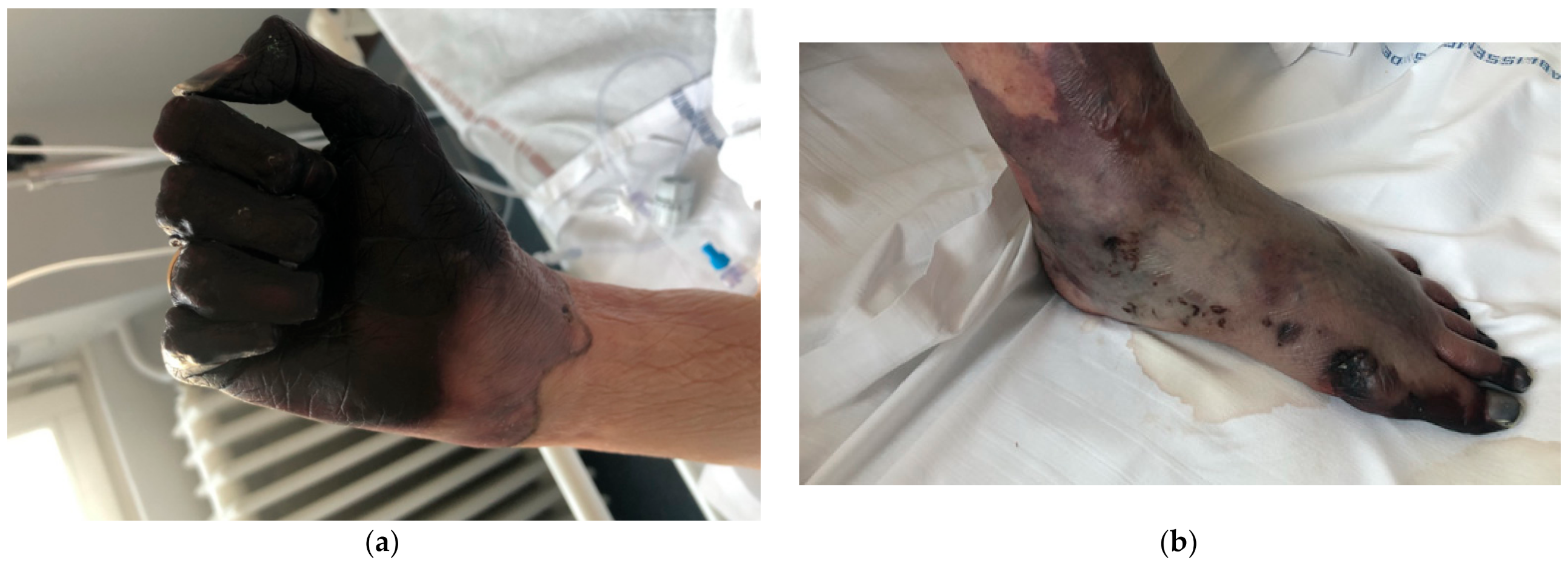 Medicina 57 00592 g002