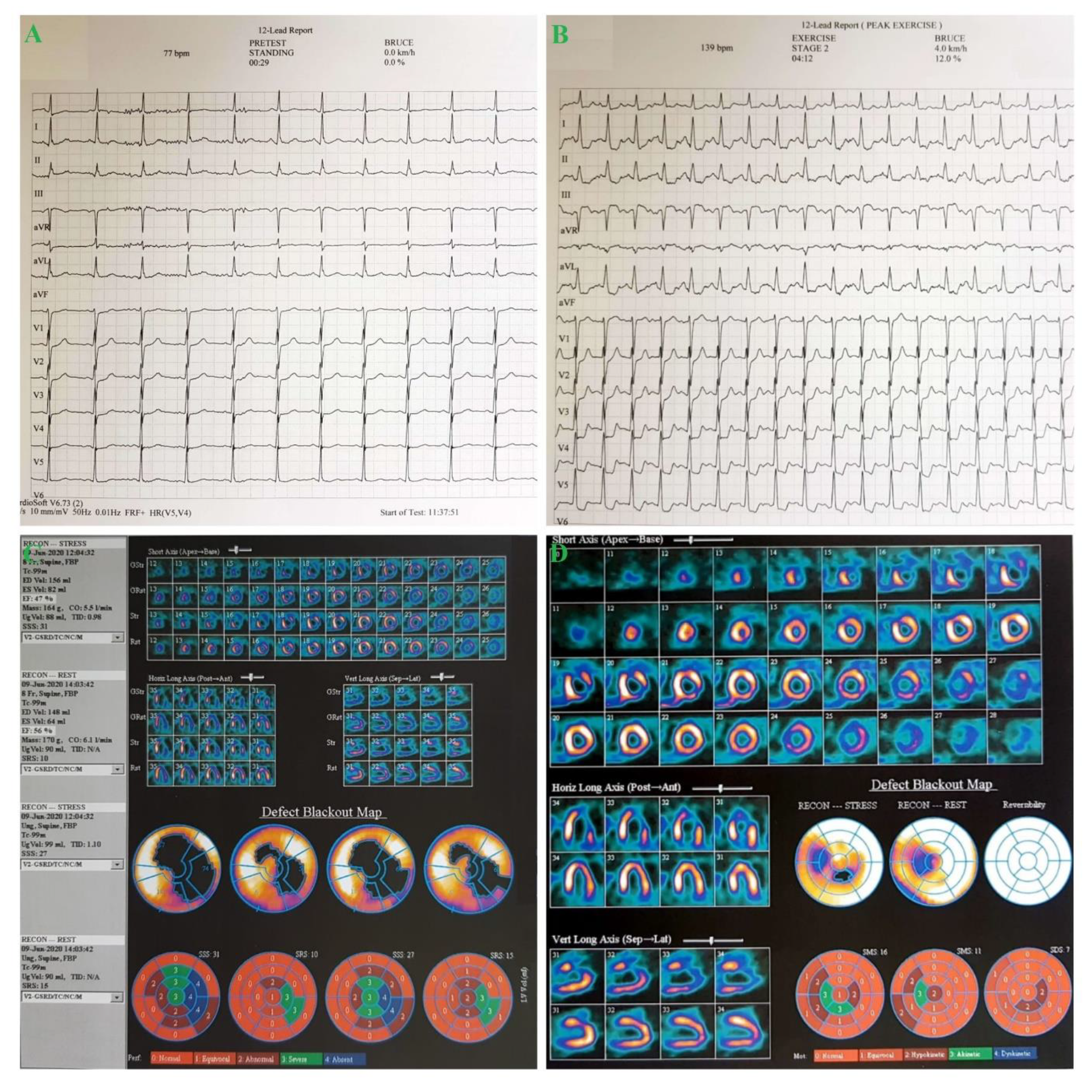Medicina 57 00595 g003 Medicina 57 00595 g003
