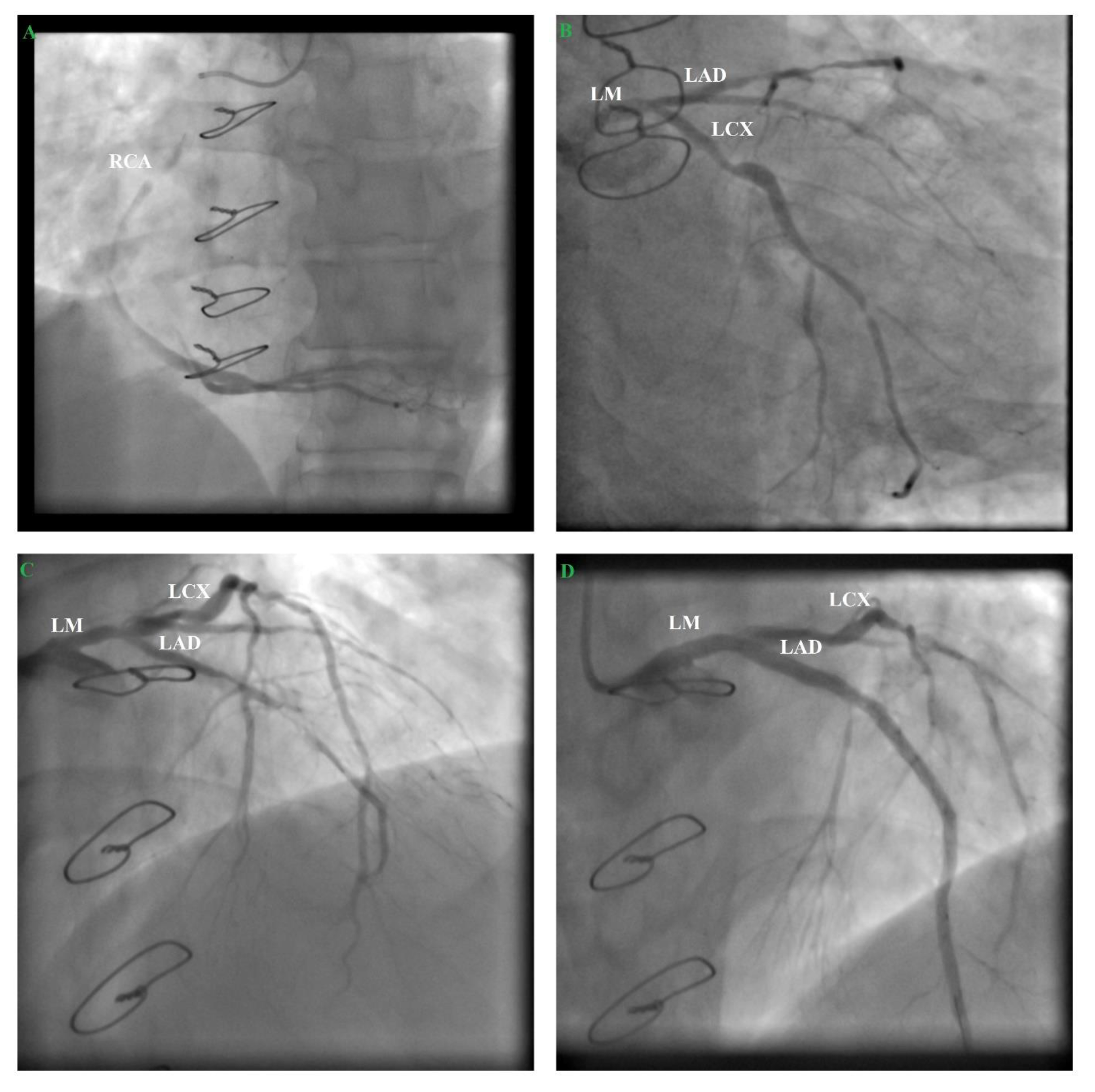 Medicina 57 00595 g004 Medicina 57 00595 g004