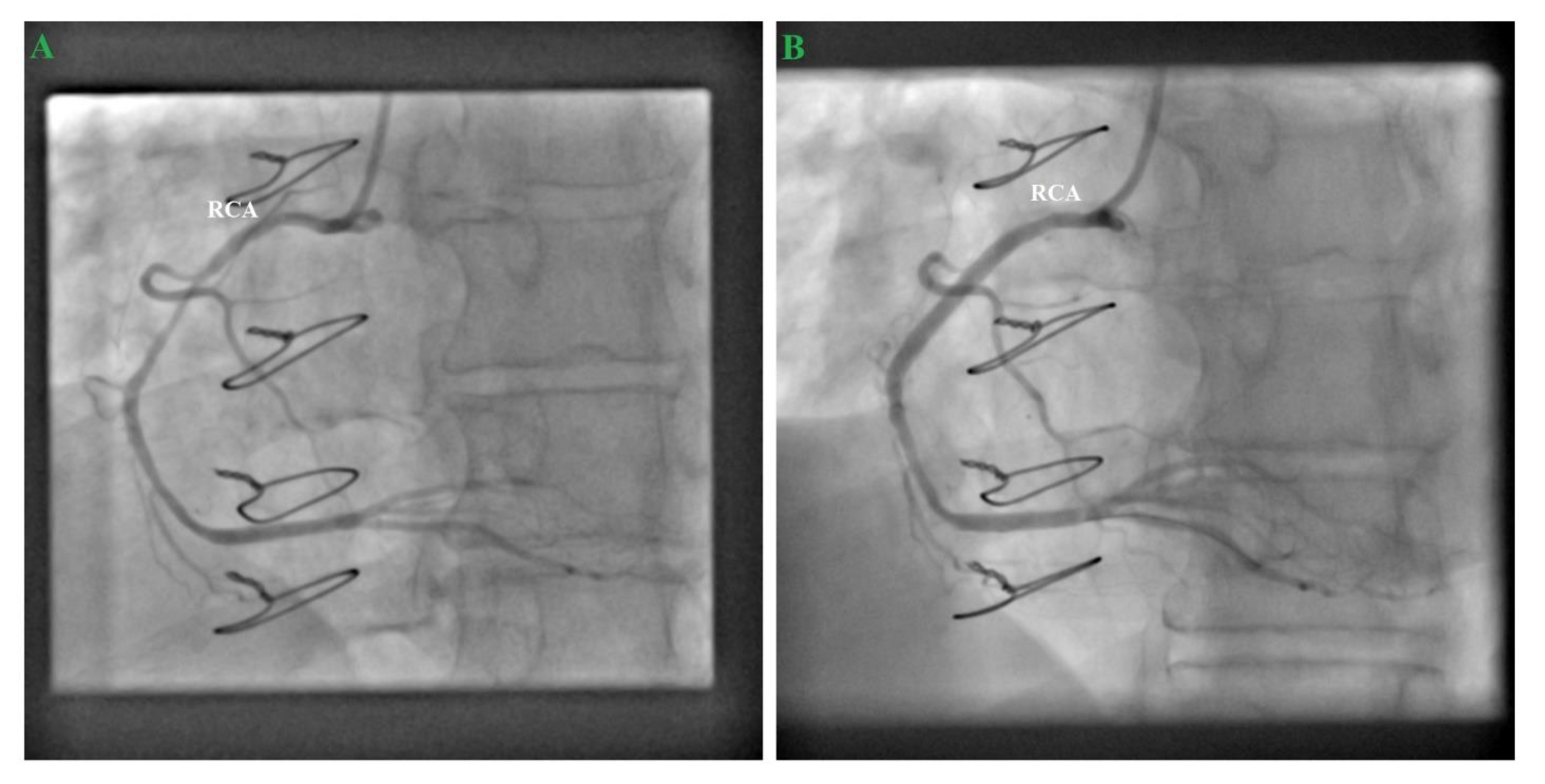 Medicina 57 00595 g005 Medicina 57 00595 g005
