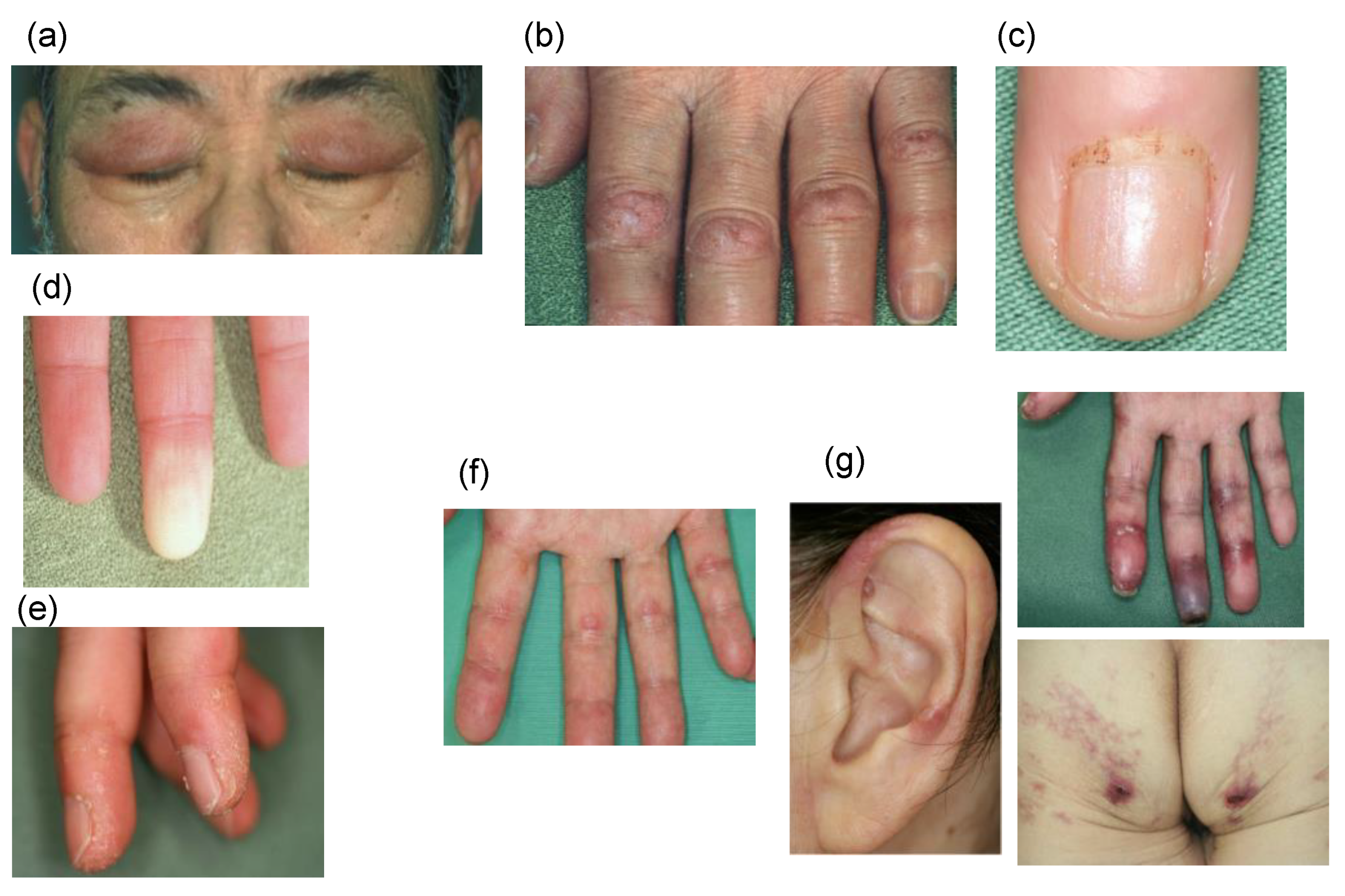 Medicina 57 00599 g001
