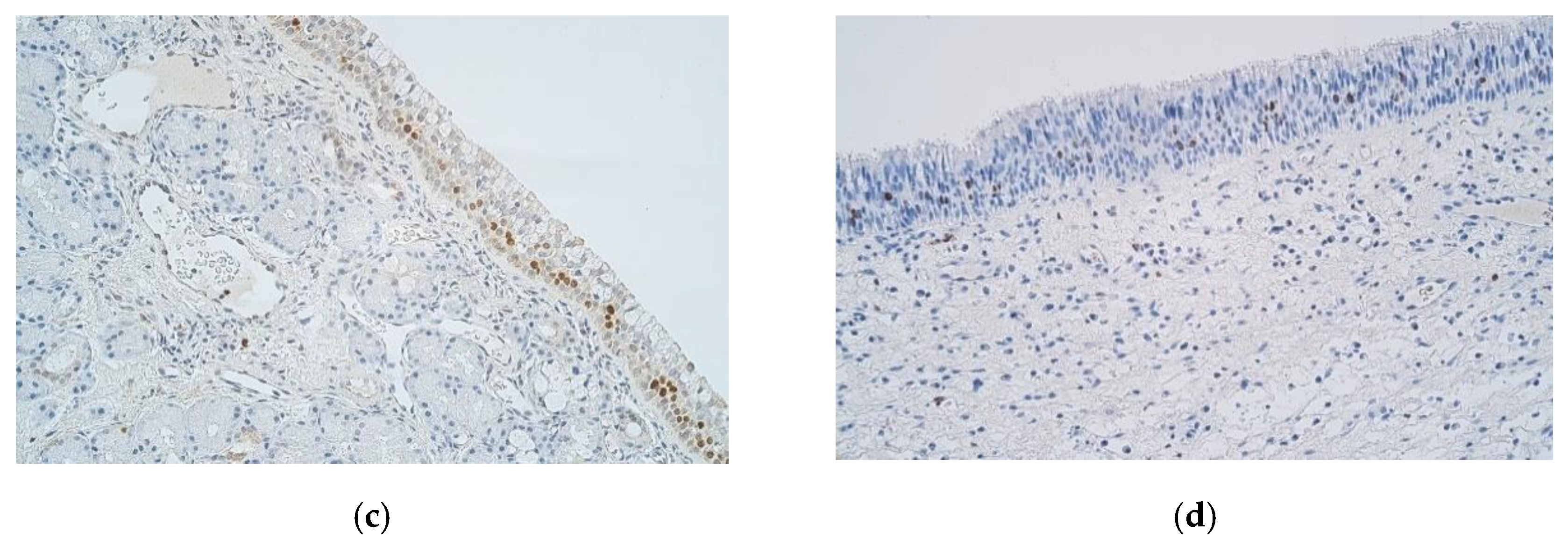 Medicina 57 00607 g005b Medicina 57 00607 g005b