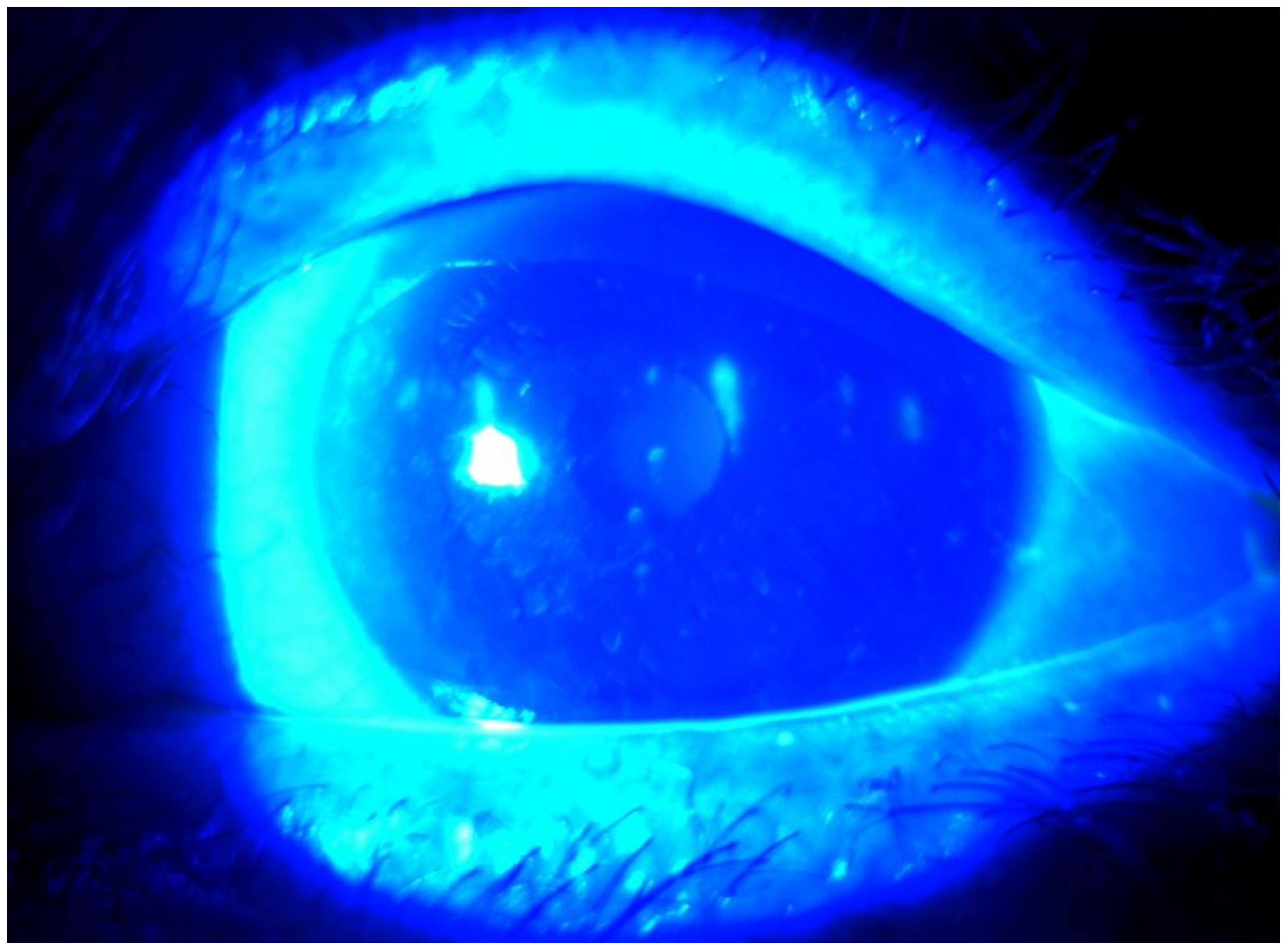 Medicina 57 00608 g004