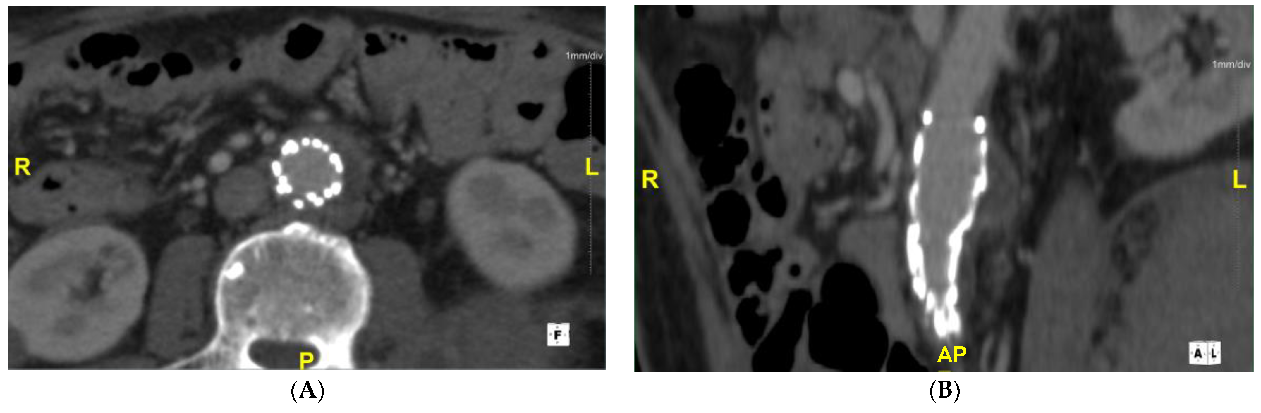 Medicina 57 00620 g003