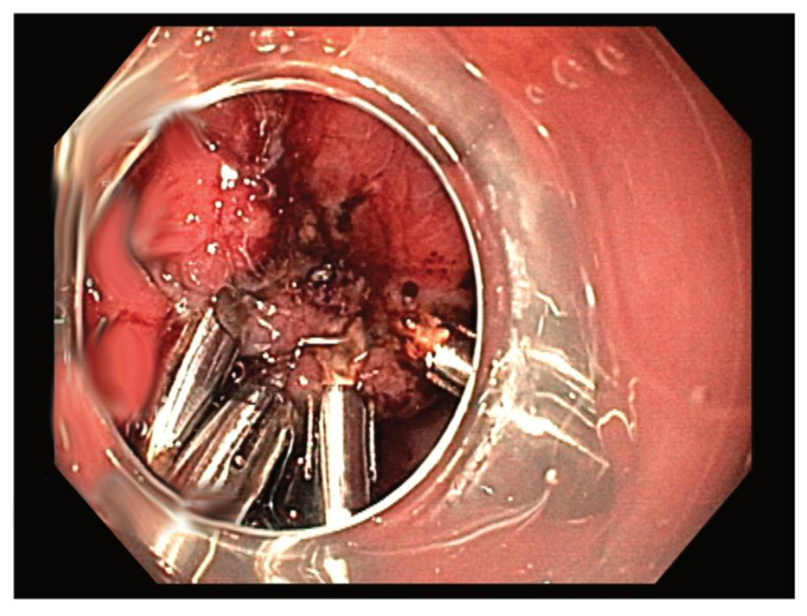 Medicina 57 00625 g002 Medicina 57 00625 g002