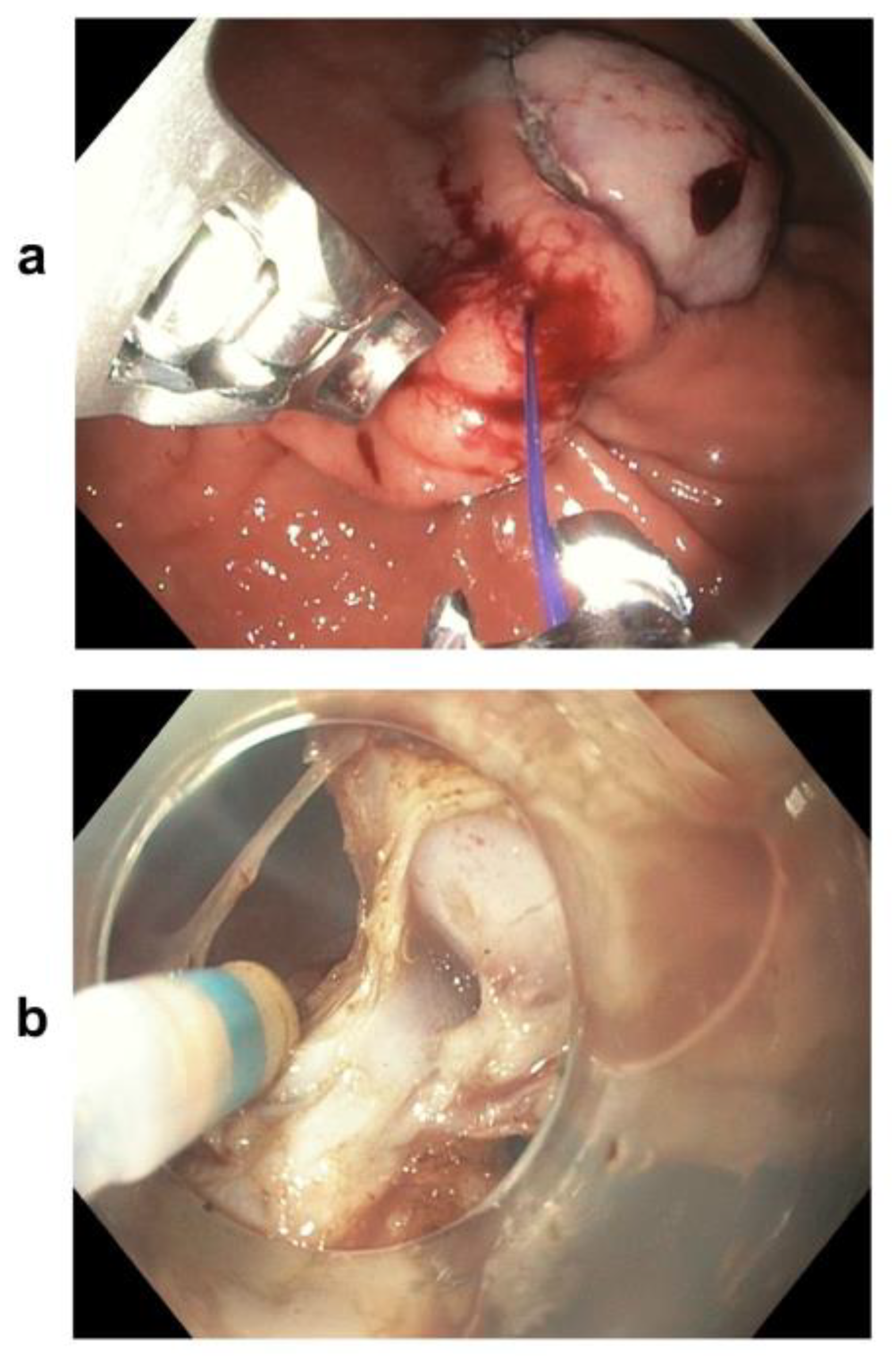 Medicina 57 00625 g003 Medicina 57 00625 g003
