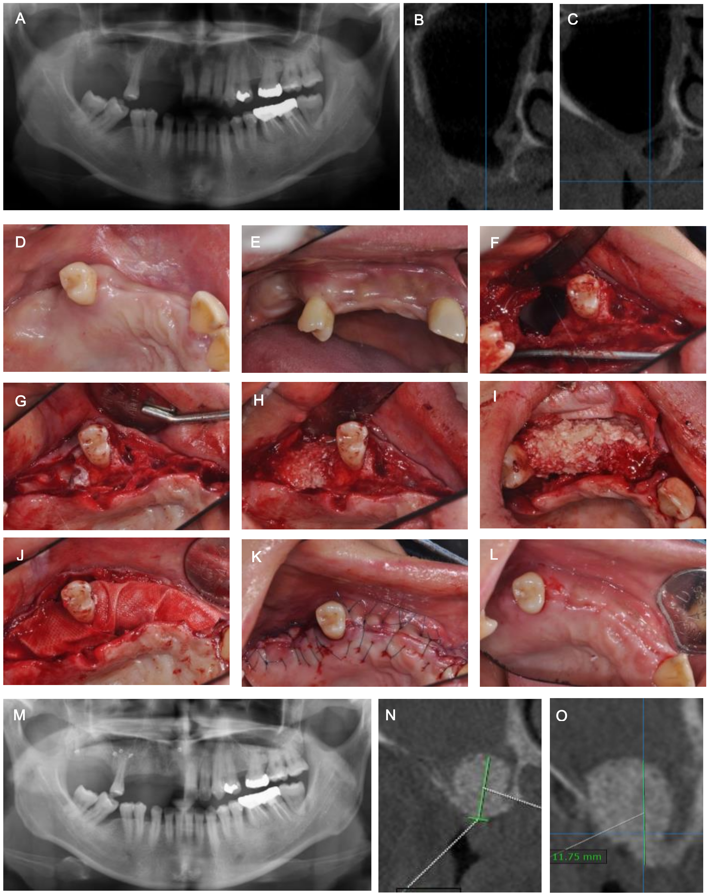 Medicina 57 00626 g001 Medicina 57 00626 g001