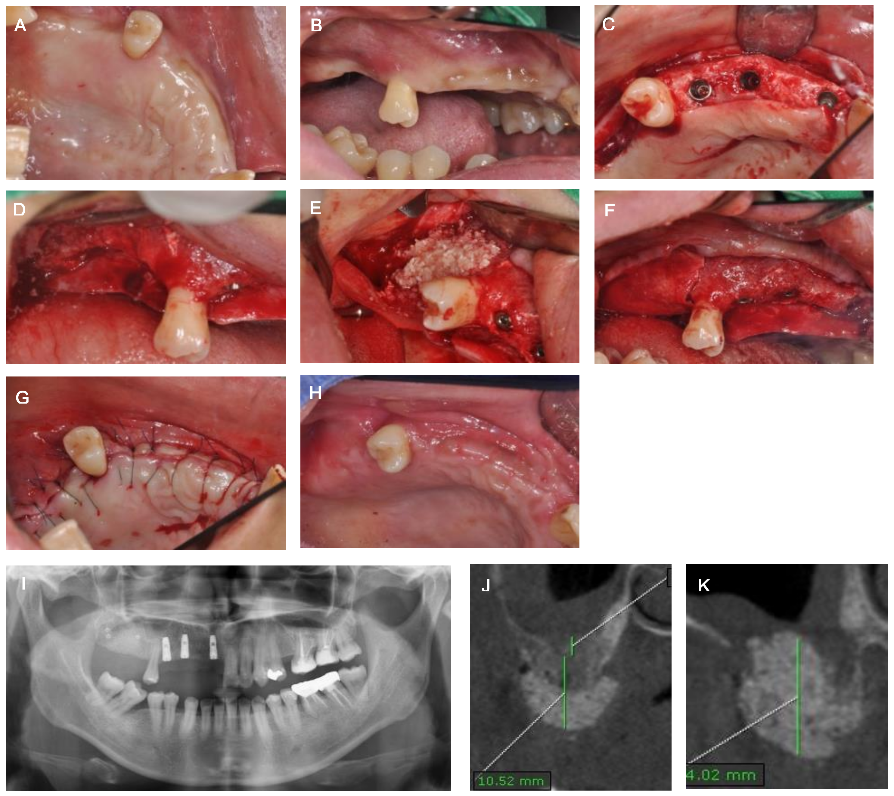 Medicina 57 00626 g002 Medicina 57 00626 g002