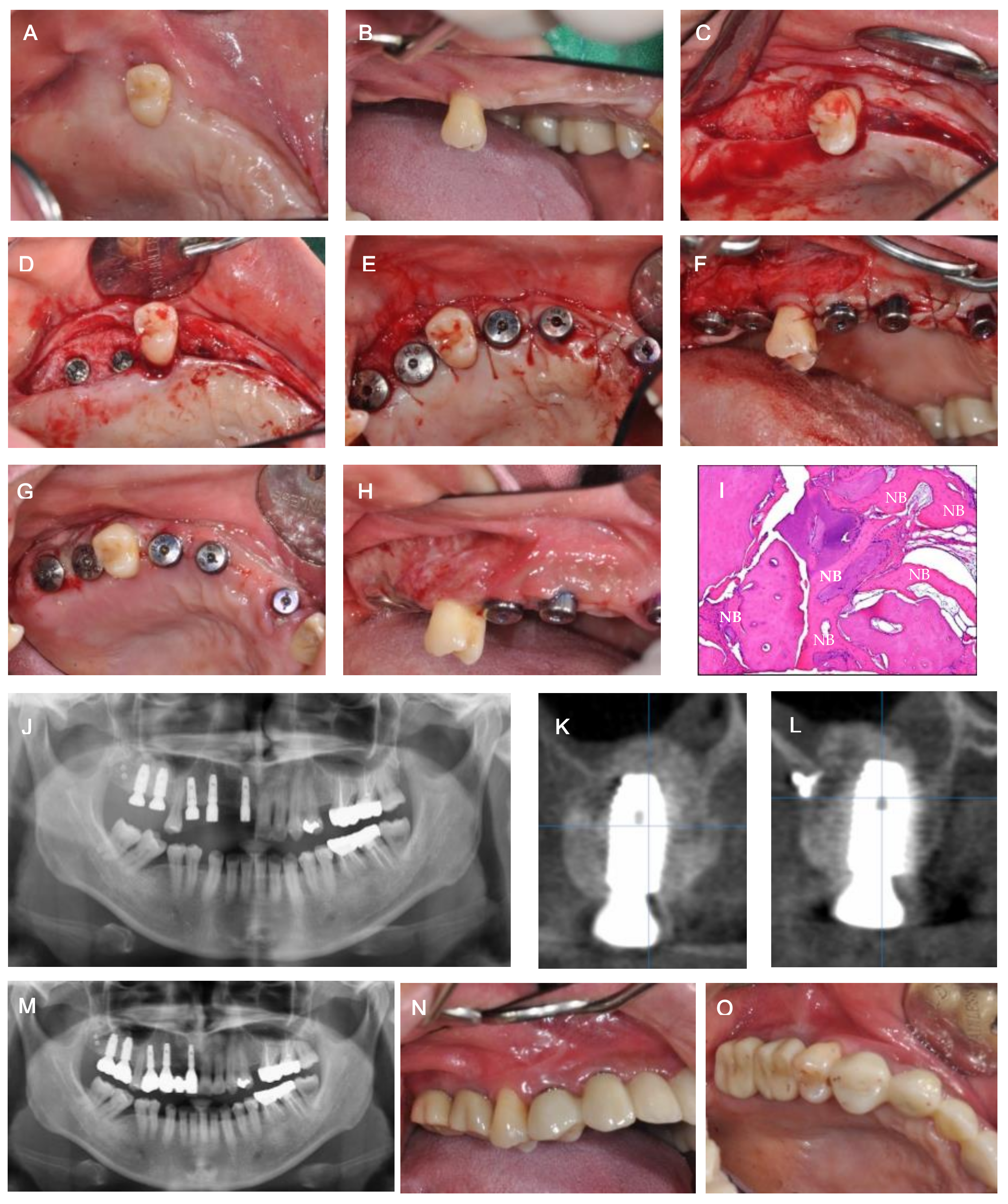 Medicina 57 00626 g003 Medicina 57 00626 g003
