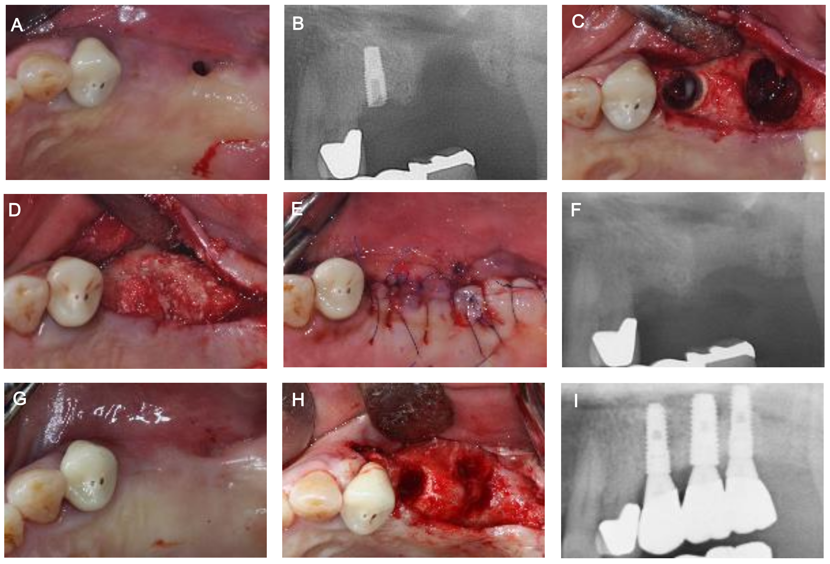 Medicina 57 00626 g004 Medicina 57 00626 g004