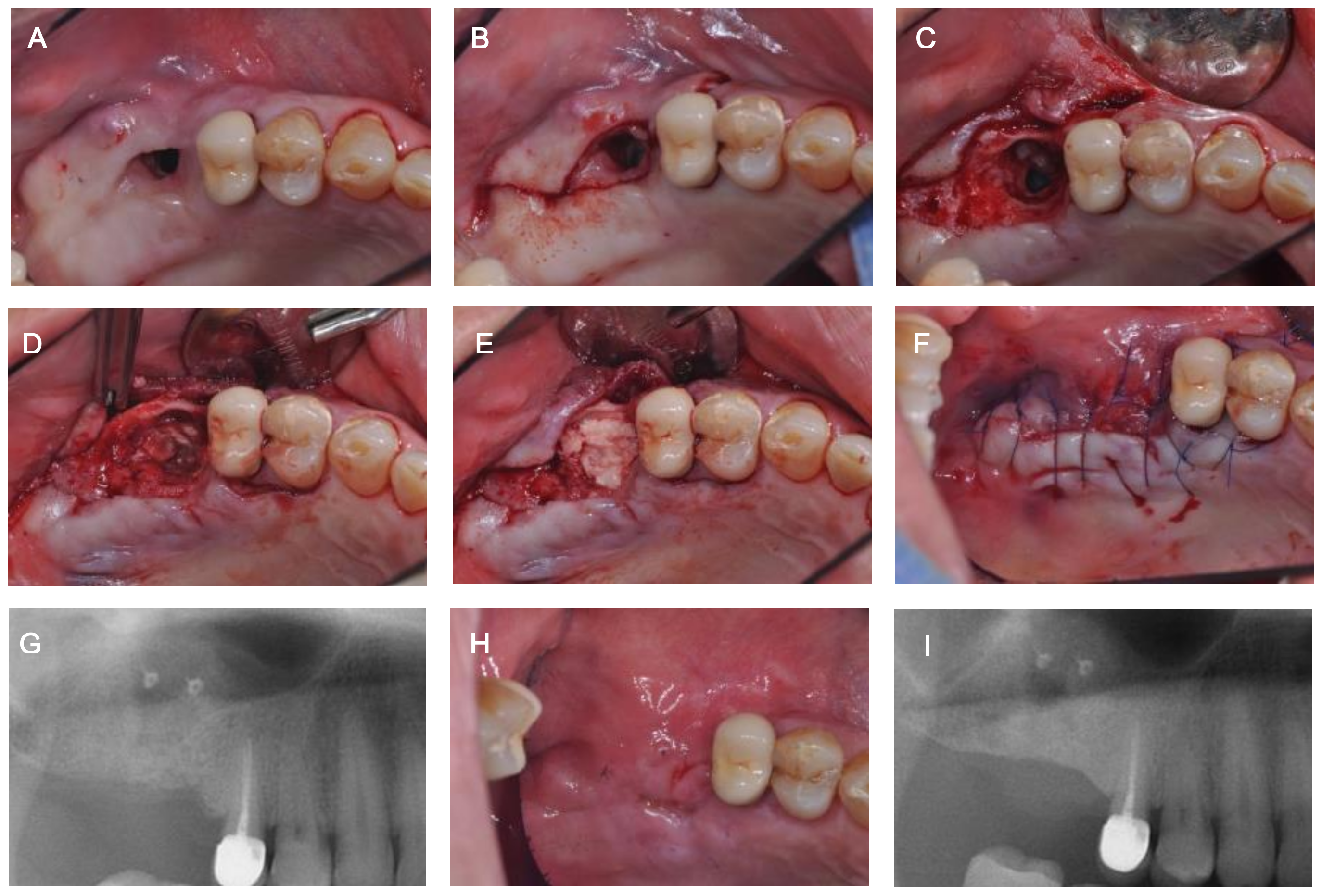 Medicina 57 00626 g005 Medicina 57 00626 g005