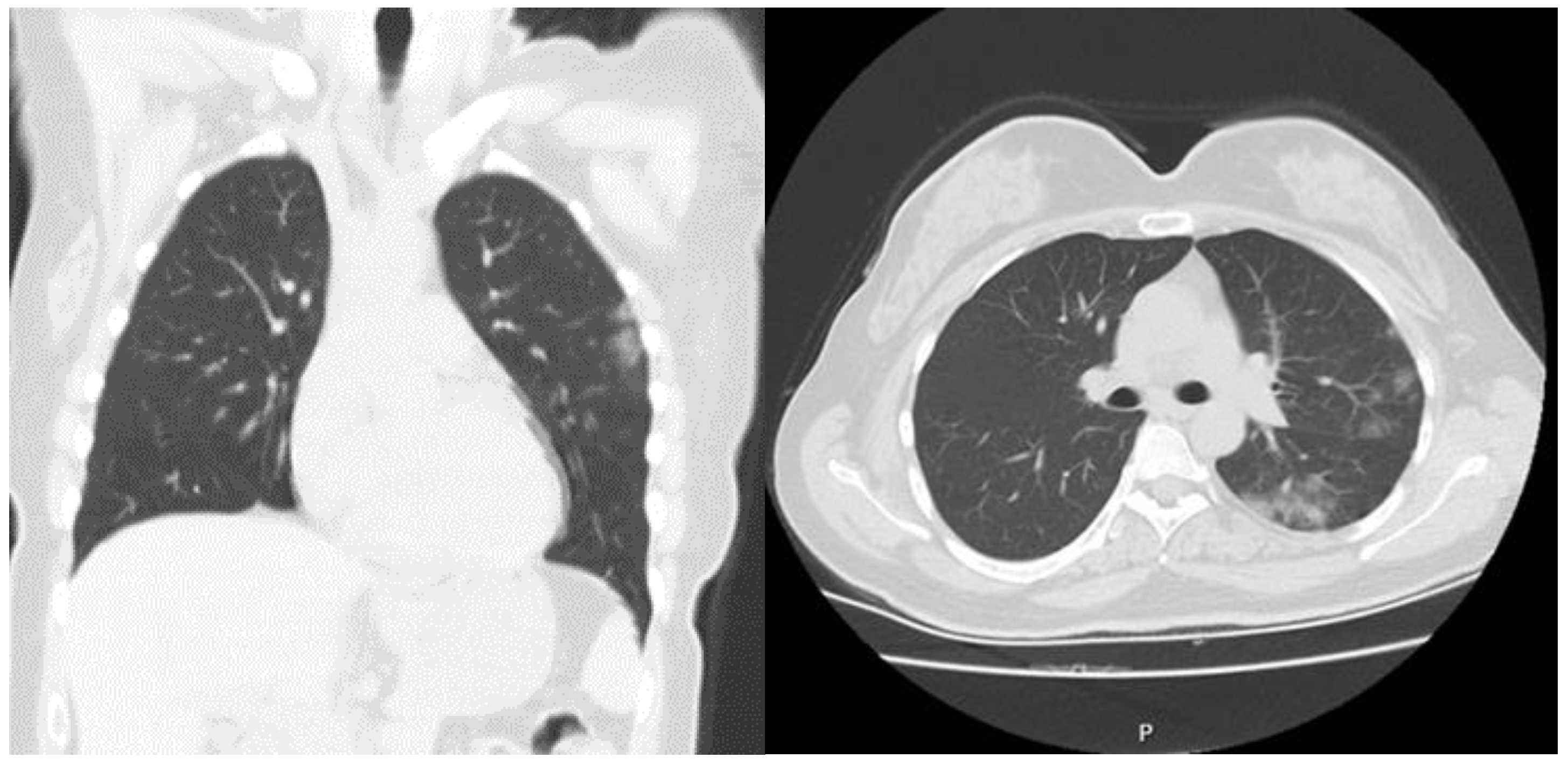 Medicina 57 00629 g003