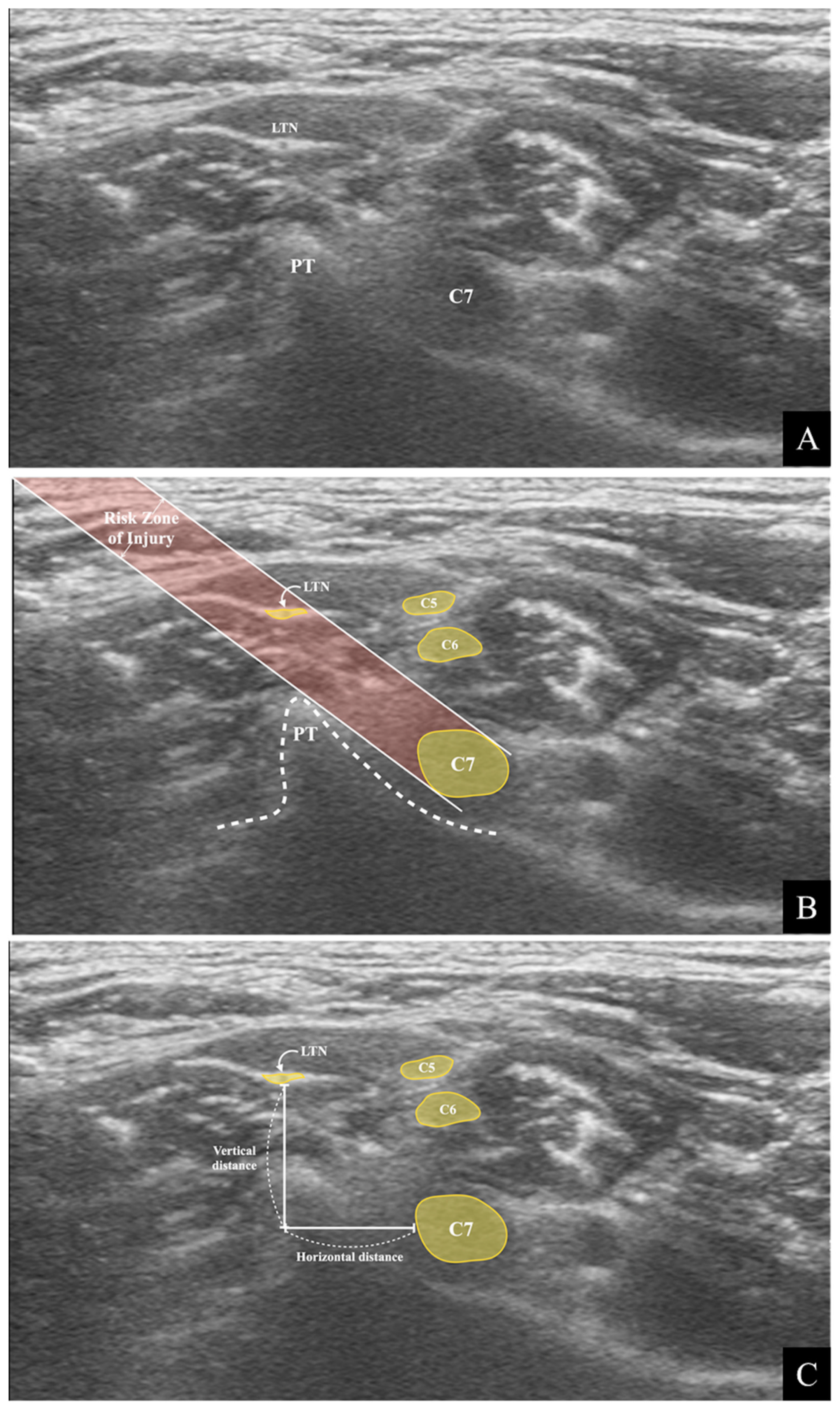 Medicina 57 00635 g002 Medicina 57 00635 g002