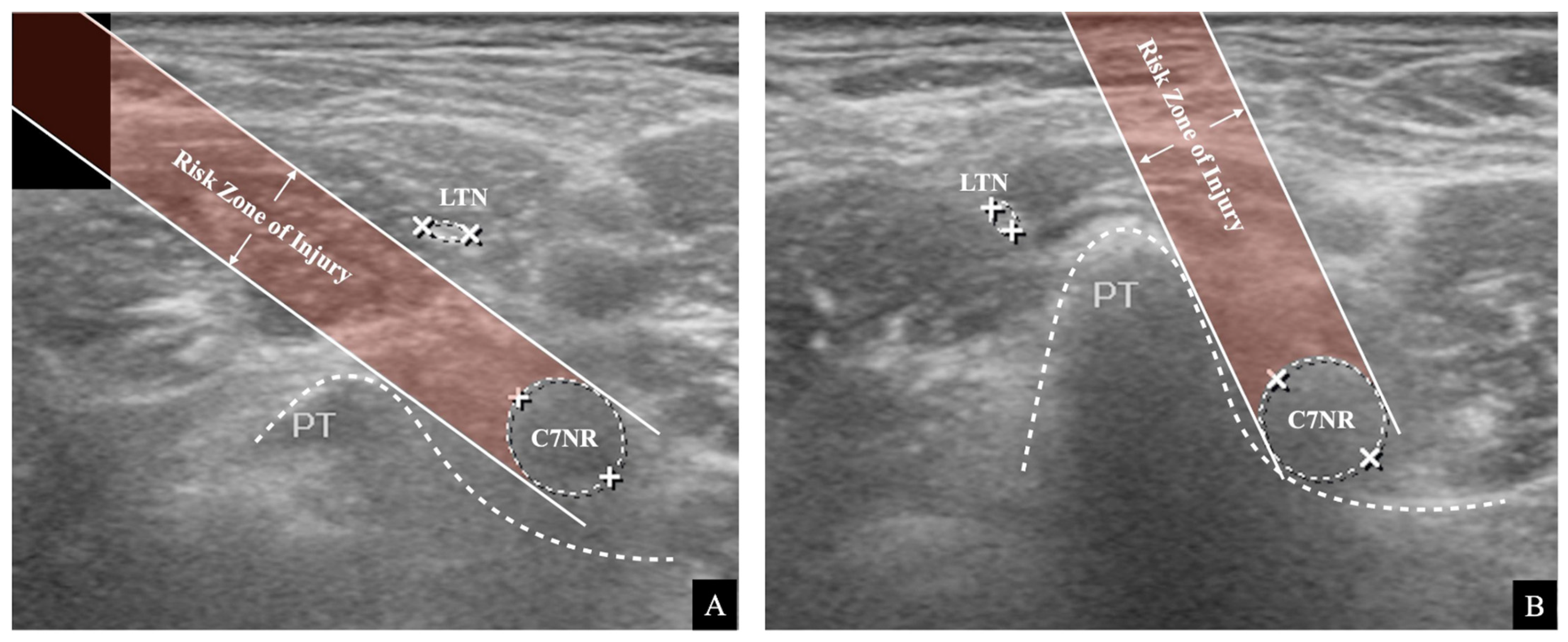 Medicina 57 00635 g005 Medicina 57 00635 g005