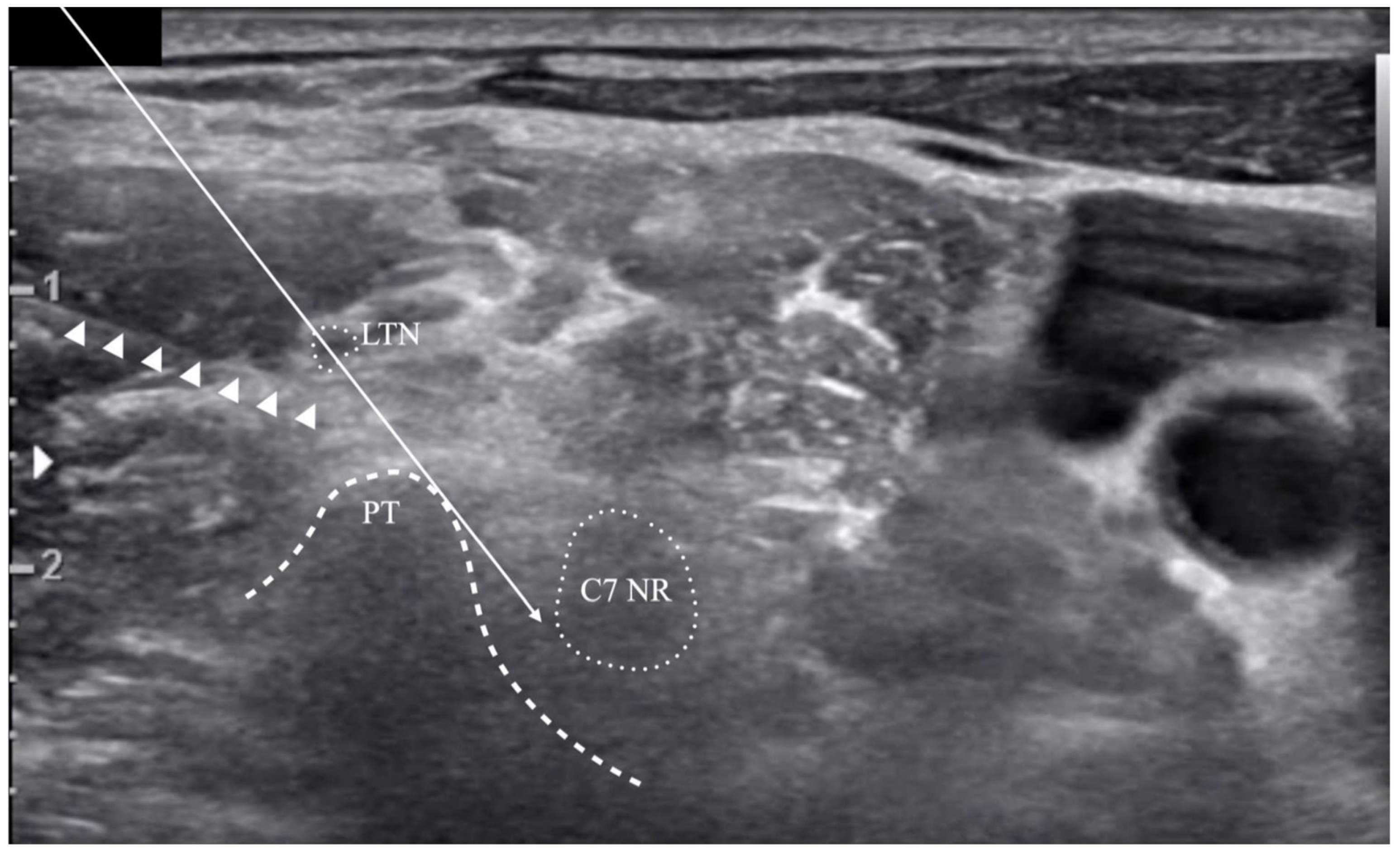 Medicina 57 00635 g006 Medicina 57 00635 g006