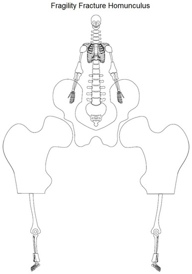 TRICHOMONAS VAGINALIS - FERTŐZéS, áTVITEL éS BETEGSéGEK - KÓROKOZÓ