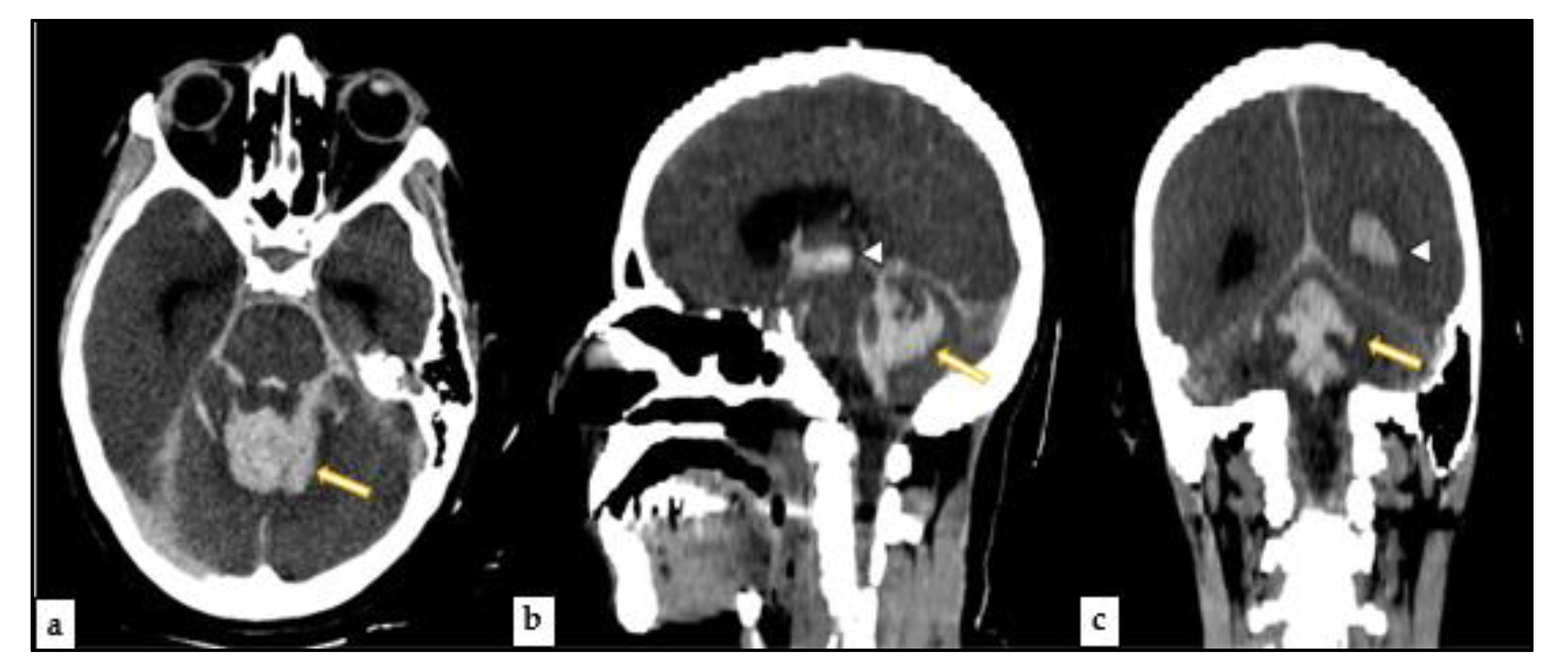Medicina 57 00644 g001 550